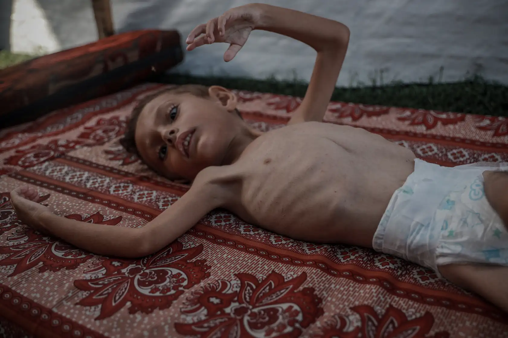 21. Yüzyılın utancı: Uzay çağında açlıktan ölen çocuklar!