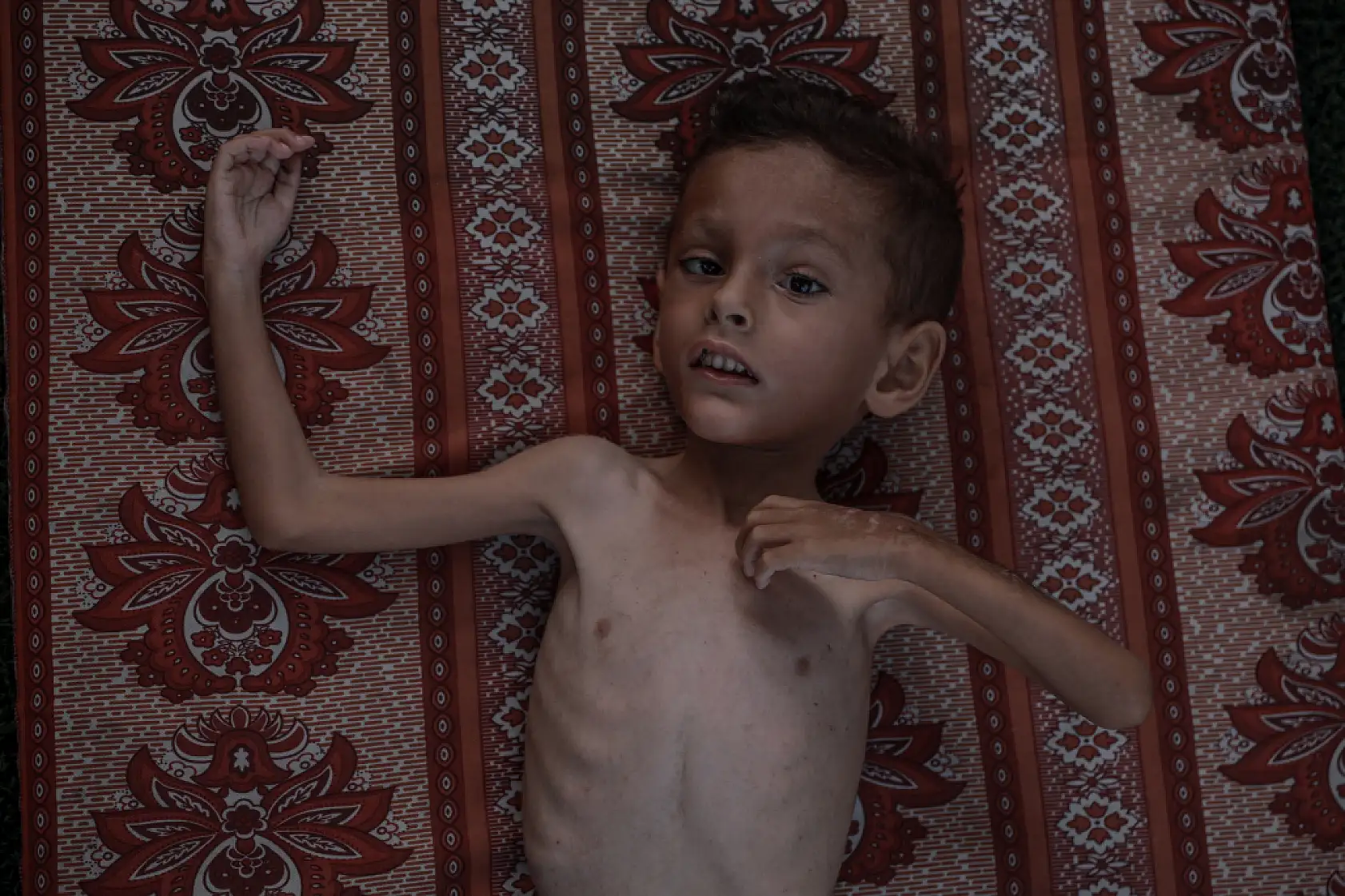 21. Yüzyılın utancı: Uzay çağında açlıktan ölen çocuklar!