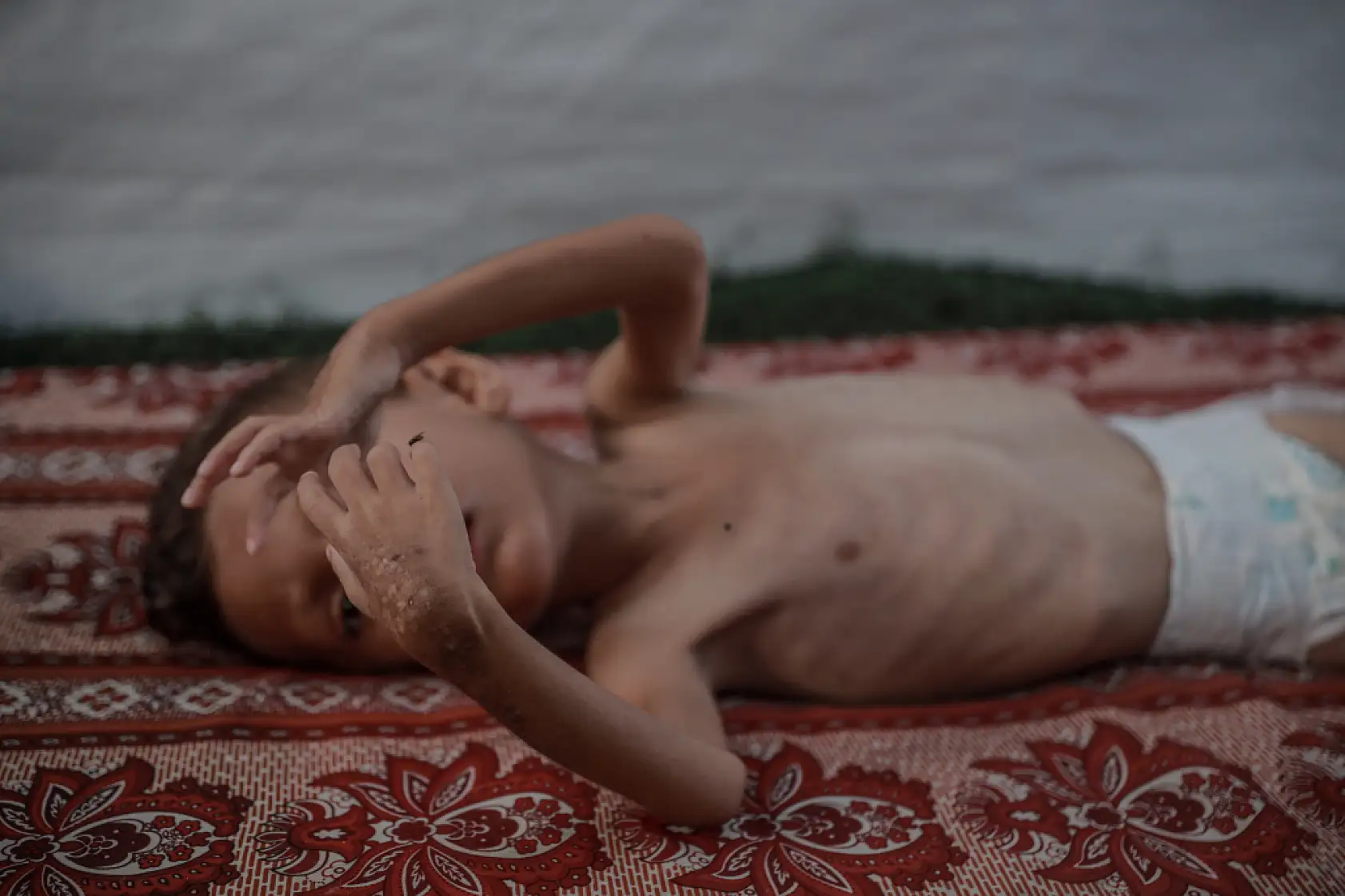 21. Yüzyılın utancı: Uzay çağında açlıktan ölen çocuklar!