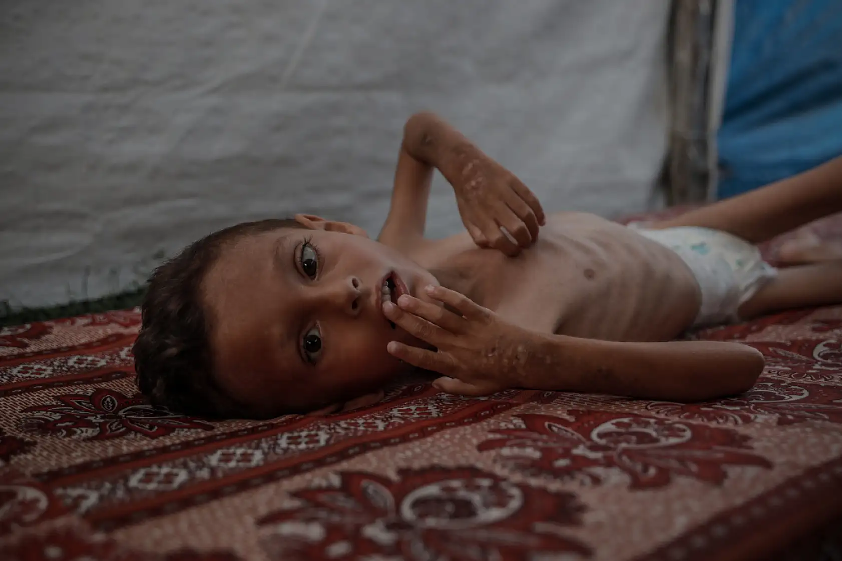 21. Yüzyılın utancı: Uzay çağında açlıktan ölen çocuklar!