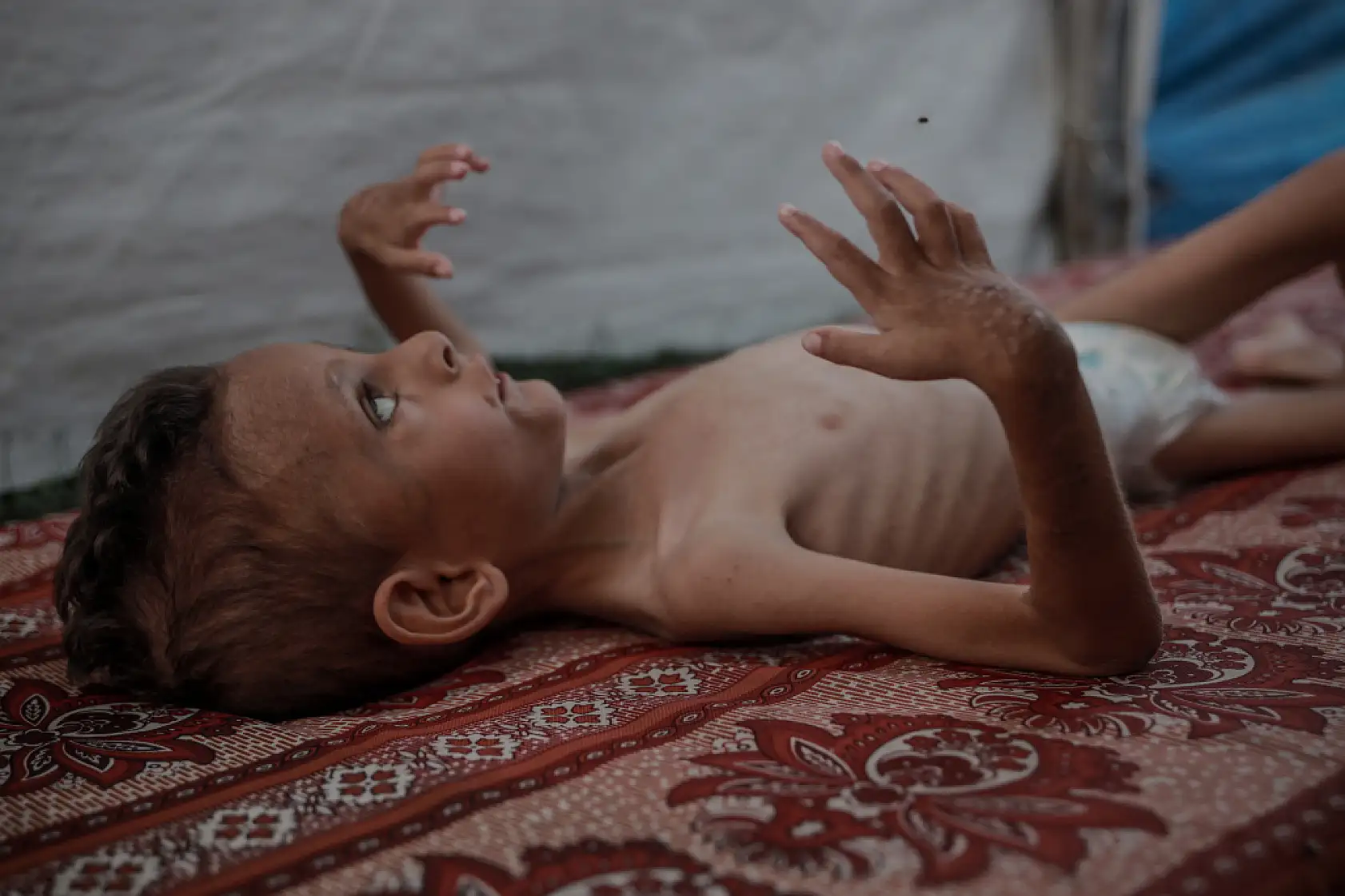 21. Yüzyılın utancı: Uzay çağında açlıktan ölen çocuklar!