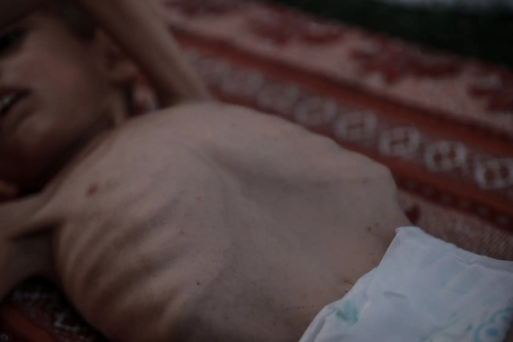 21. Yüzyılın utancı: Uzay çağında açlıktan ölen çocuklar!