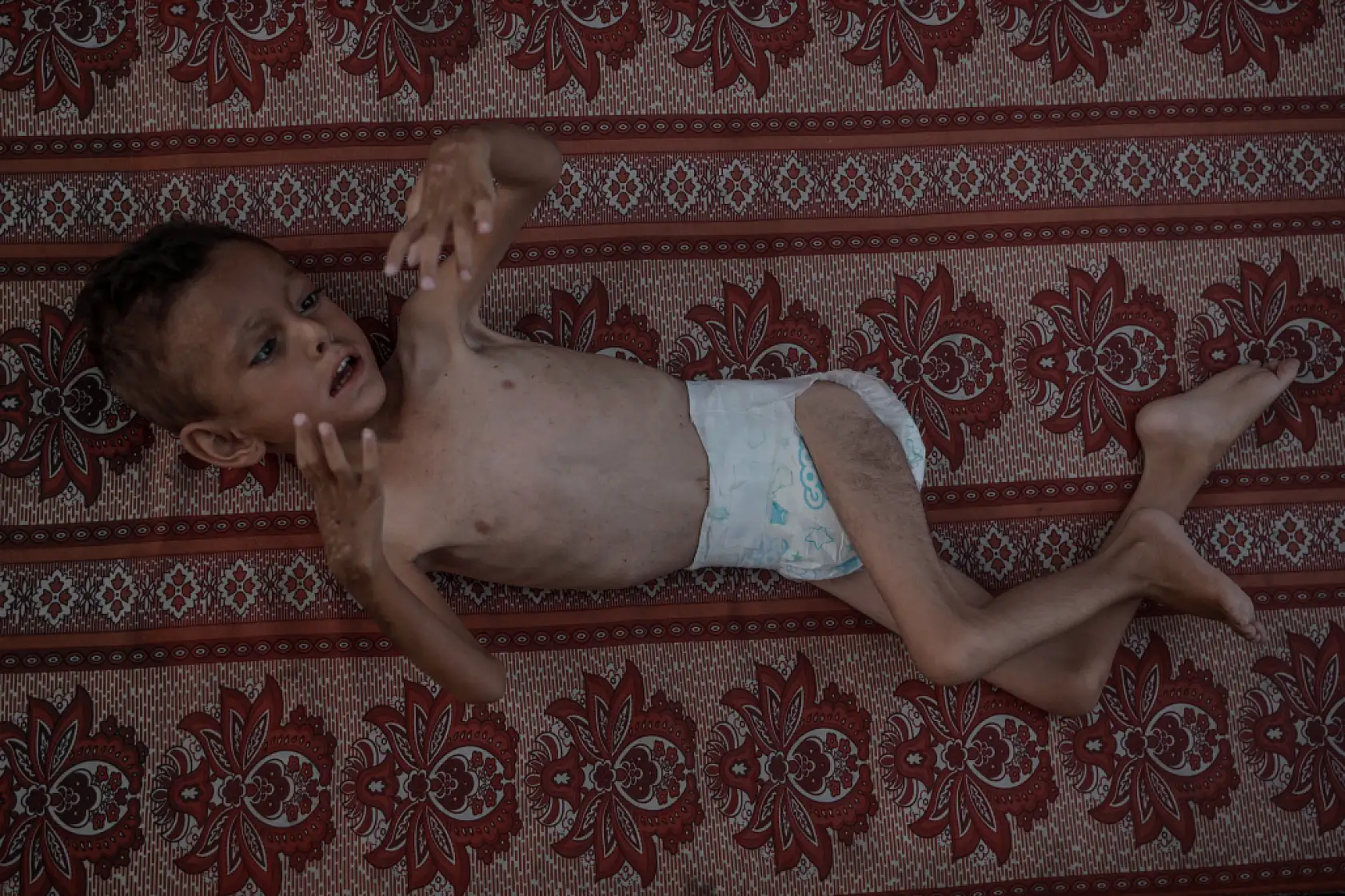 21. Yüzyılın utancı: Uzay çağında açlıktan ölen çocuklar!