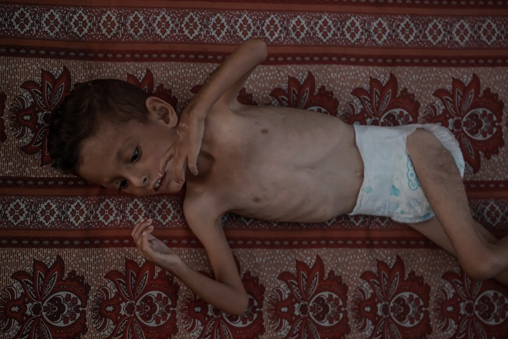 21. Yüzyılın utancı: Uzay çağında açlıktan ölen çocuklar!