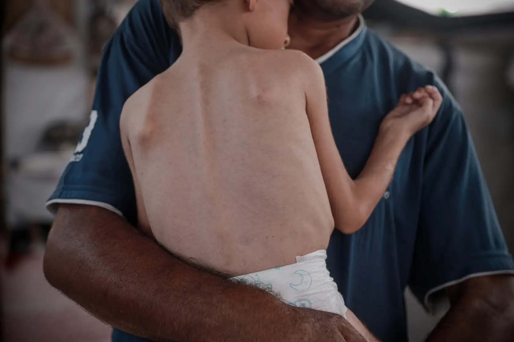 21. Yüzyılın utancı: Uzay çağında açlıktan ölen çocuklar!