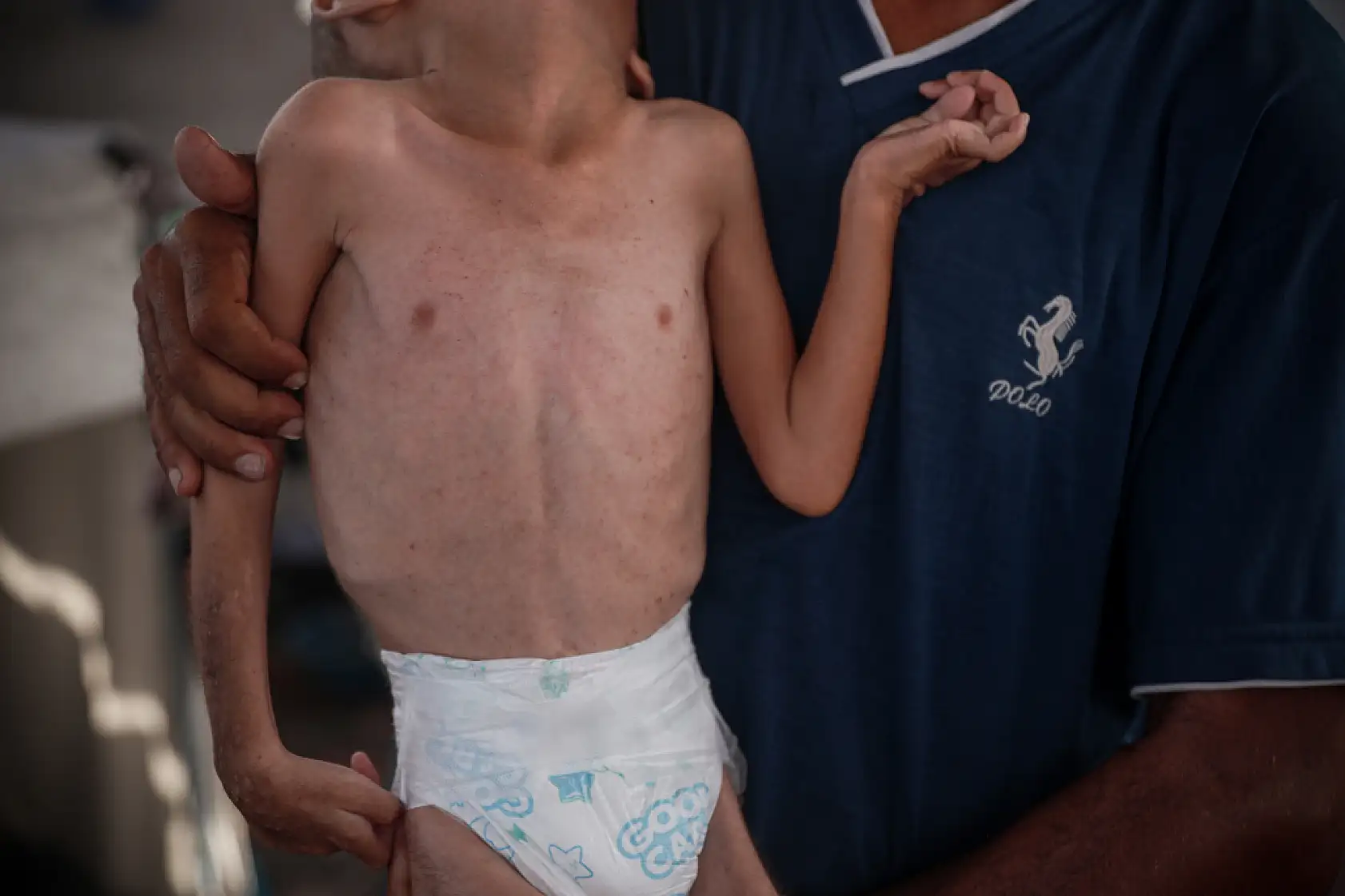 21. Yüzyılın utancı: Uzay çağında açlıktan ölen çocuklar!