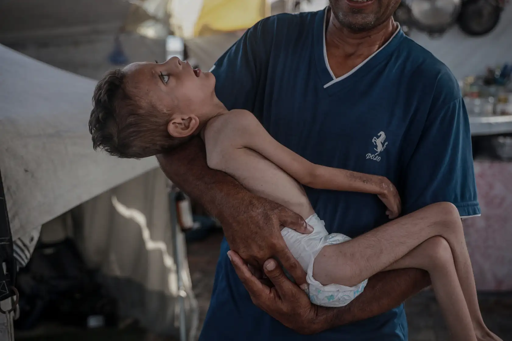 21. Yüzyılın utancı: Uzay çağında açlıktan ölen çocuklar!