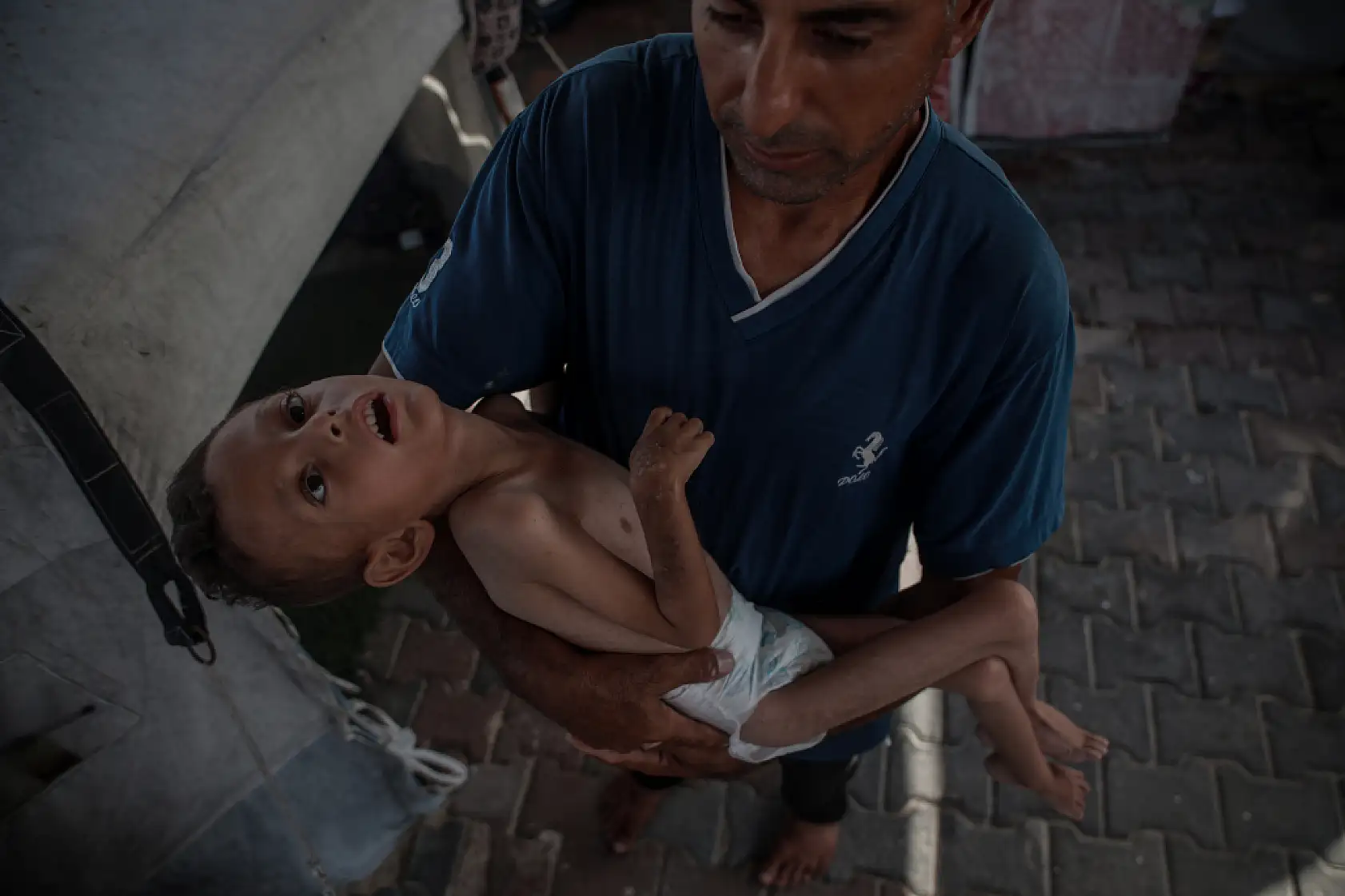 21. Yüzyılın utancı: Uzay çağında açlıktan ölen çocuklar!