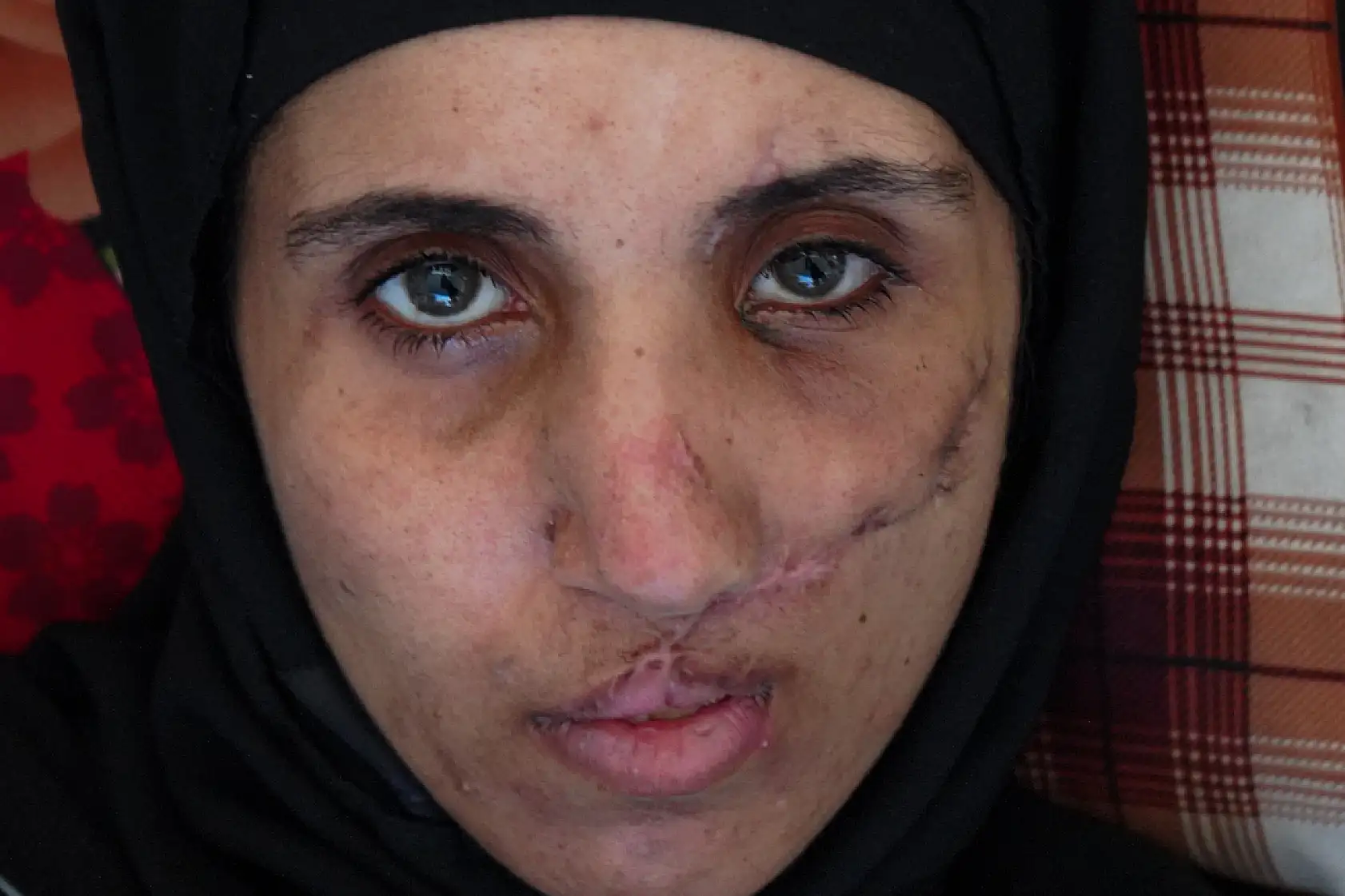 Saldırıların hedefi olan aile, yaşam mücadelesi veriyor