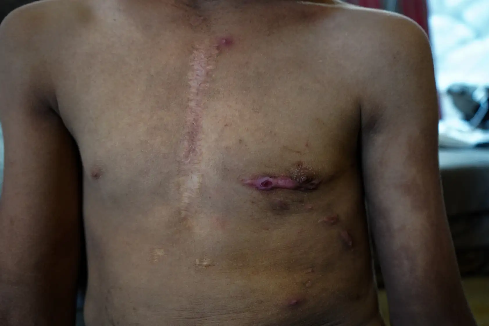 Saldırıların hedefi olan aile, yaşam mücadelesi veriyor