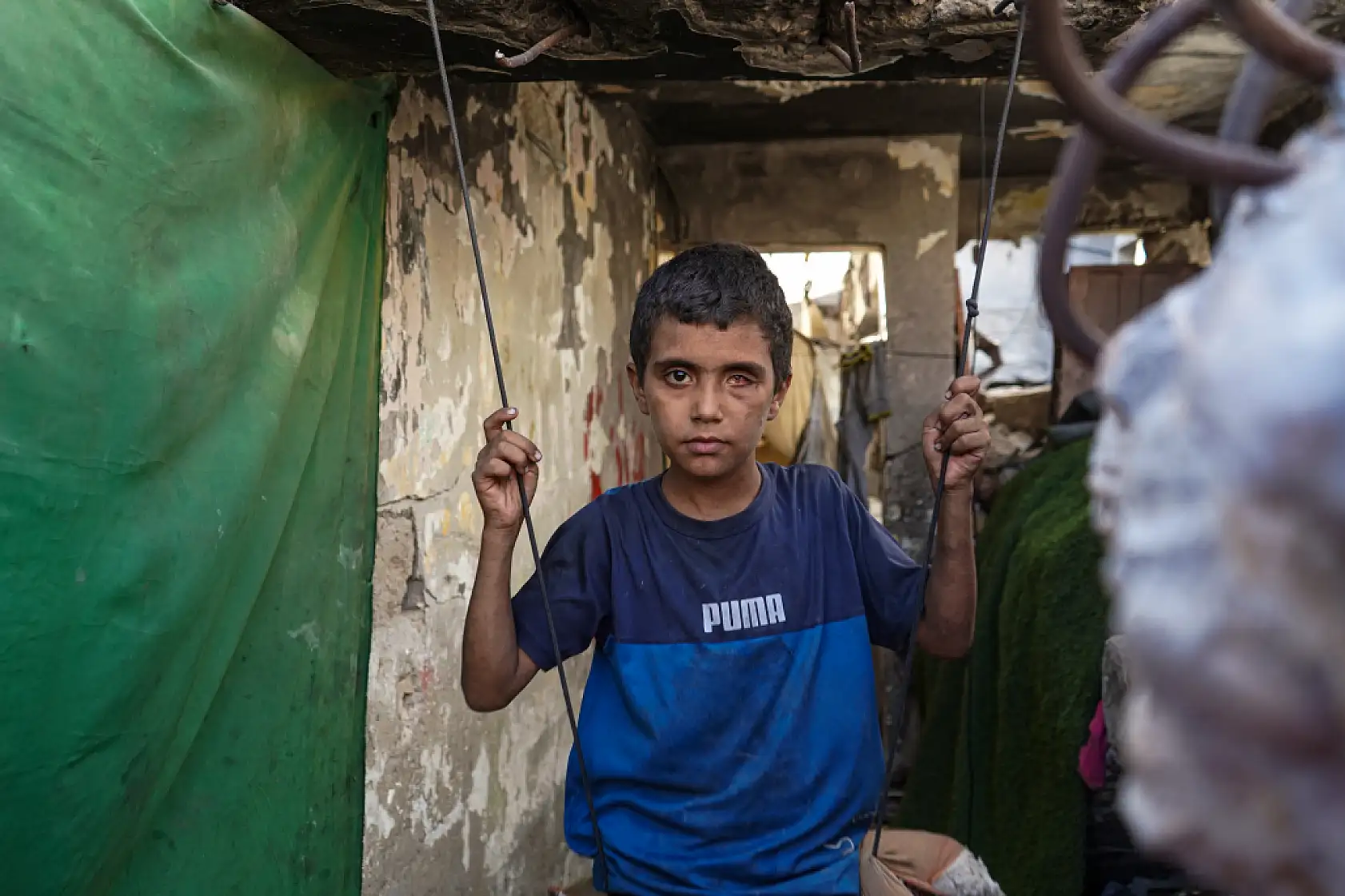 Saldırıların hedefi olan aile, yaşam mücadelesi veriyor