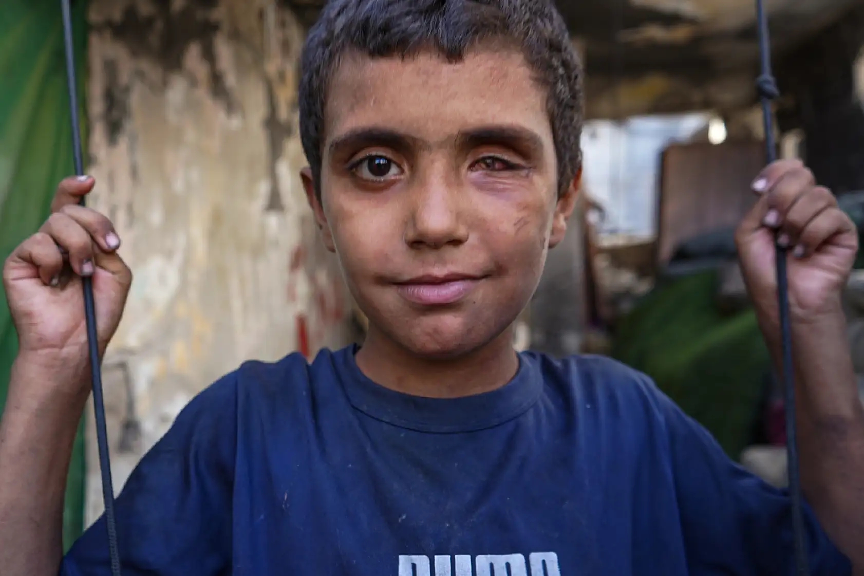 Saldırıların hedefi olan aile, yaşam mücadelesi veriyor