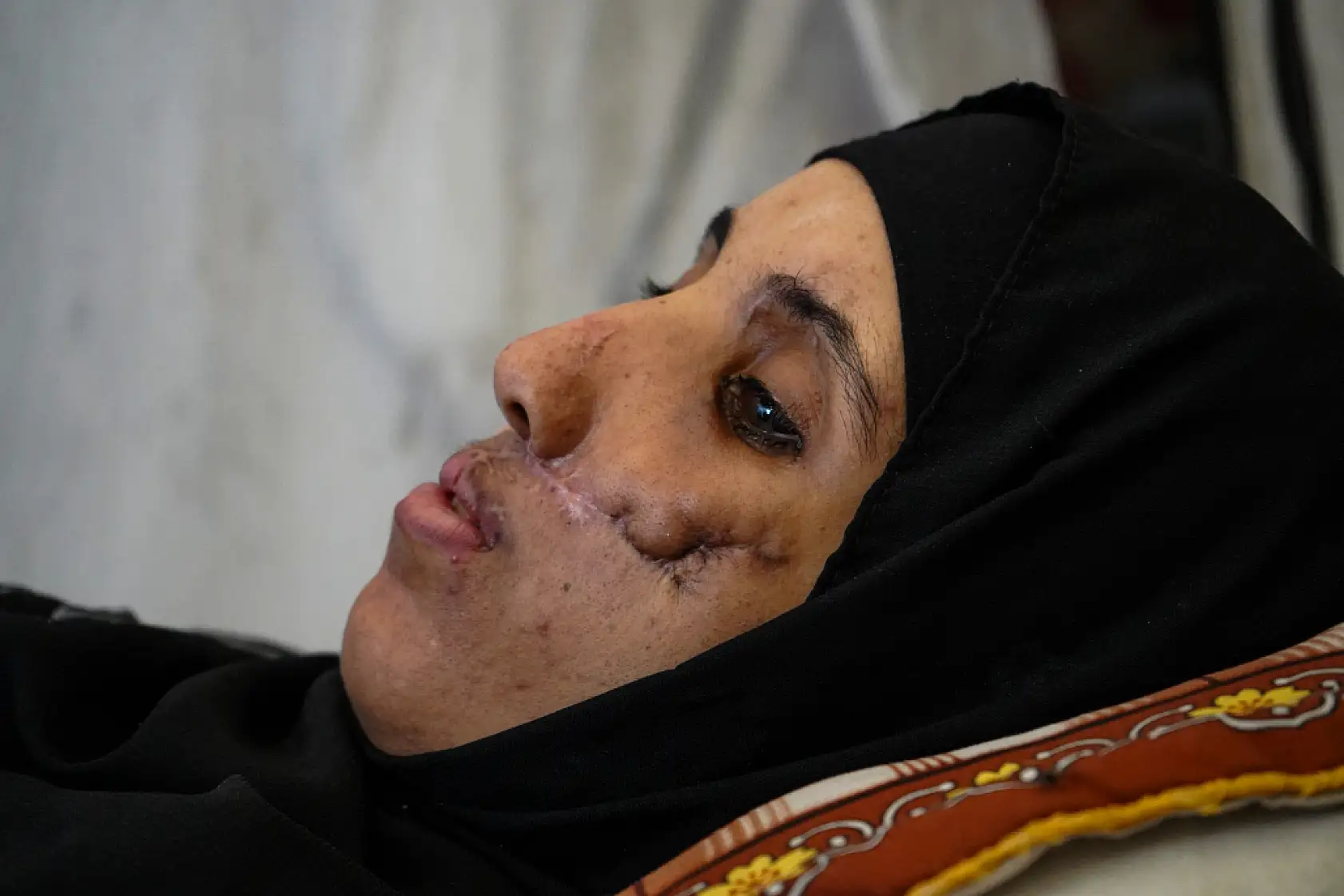 Saldırıların hedefi olan aile, yaşam mücadelesi veriyor