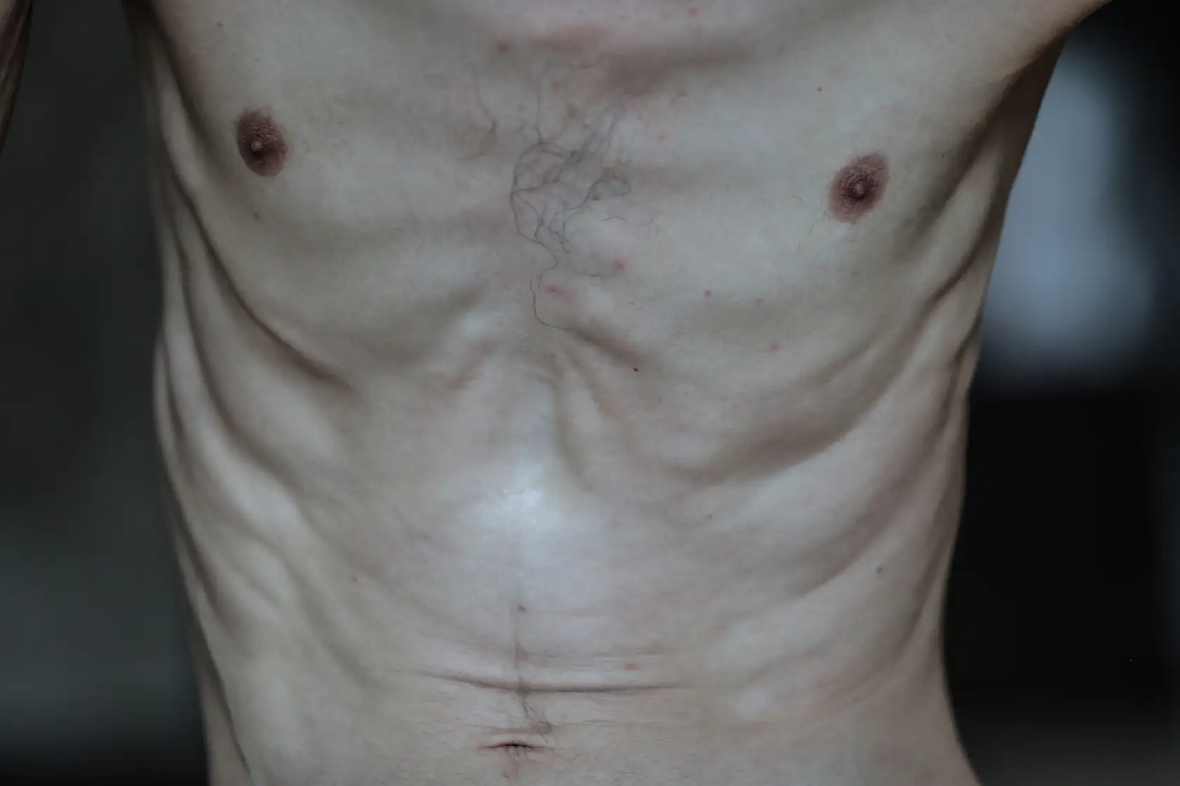 Açlık krizi gün geçtikçe derinleşiyor!