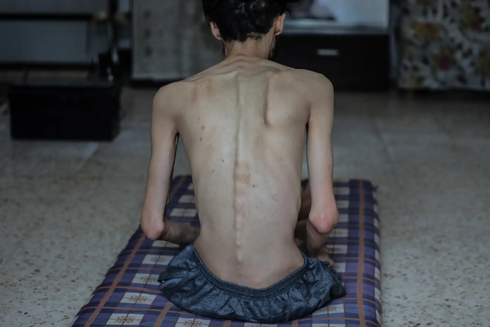 Açlık krizi gün geçtikçe derinleşiyor!