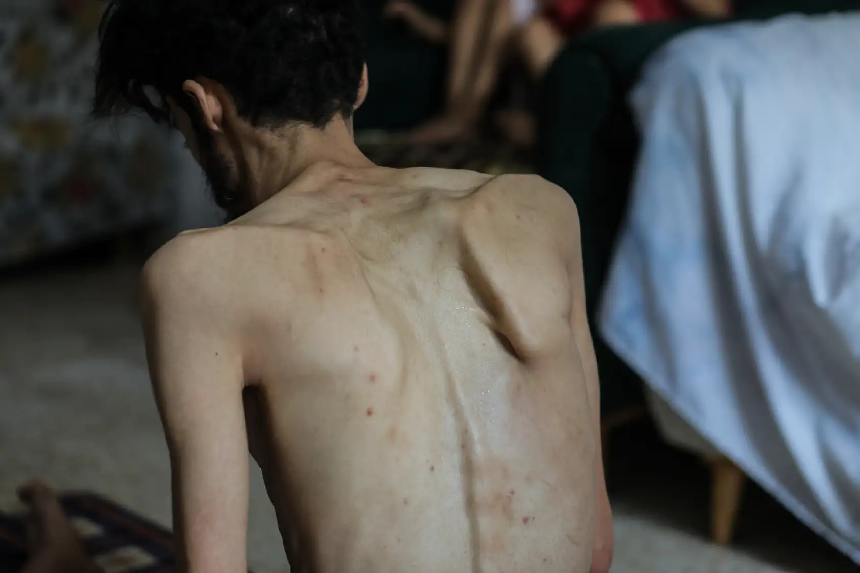 Açlık krizi gün geçtikçe derinleşiyor!