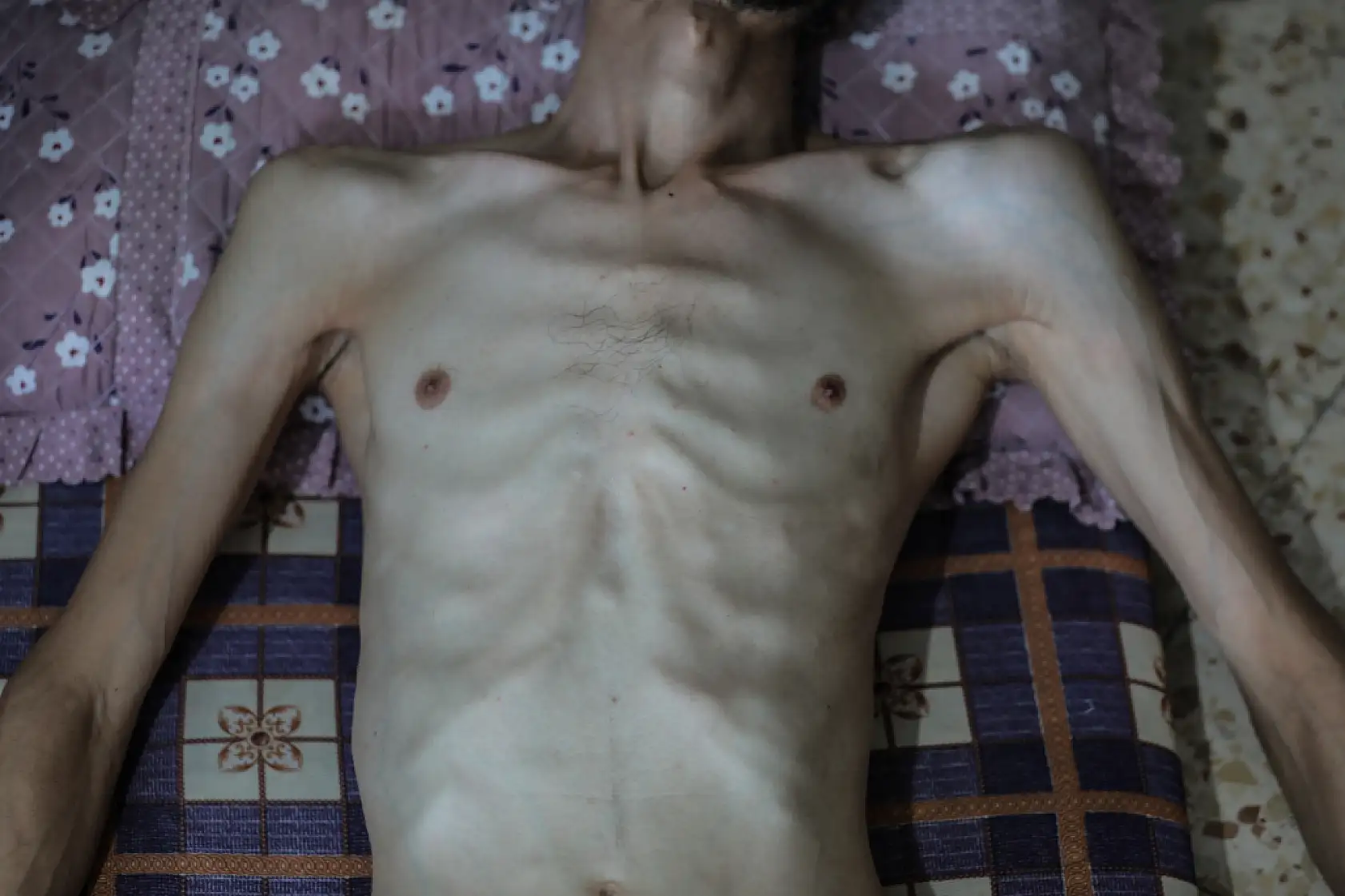 Açlık krizi gün geçtikçe derinleşiyor!