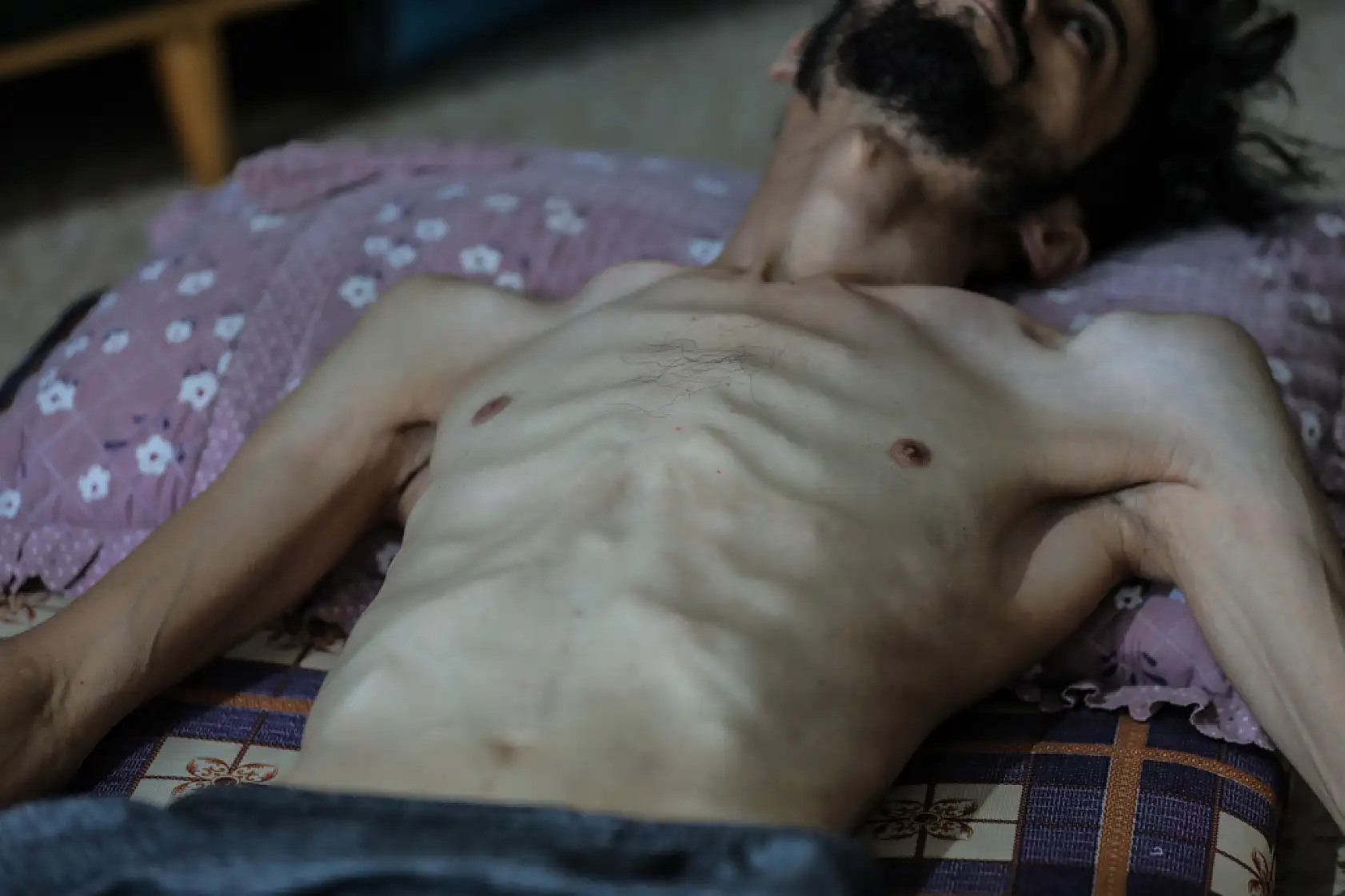 Açlık krizi gün geçtikçe derinleşiyor!