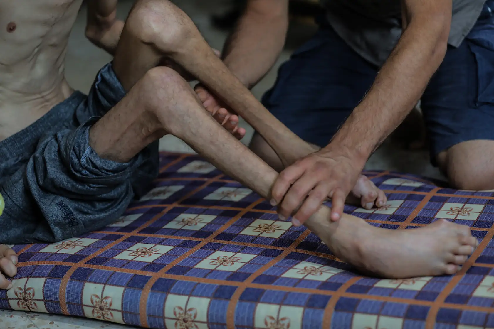 Açlık krizi gün geçtikçe derinleşiyor!