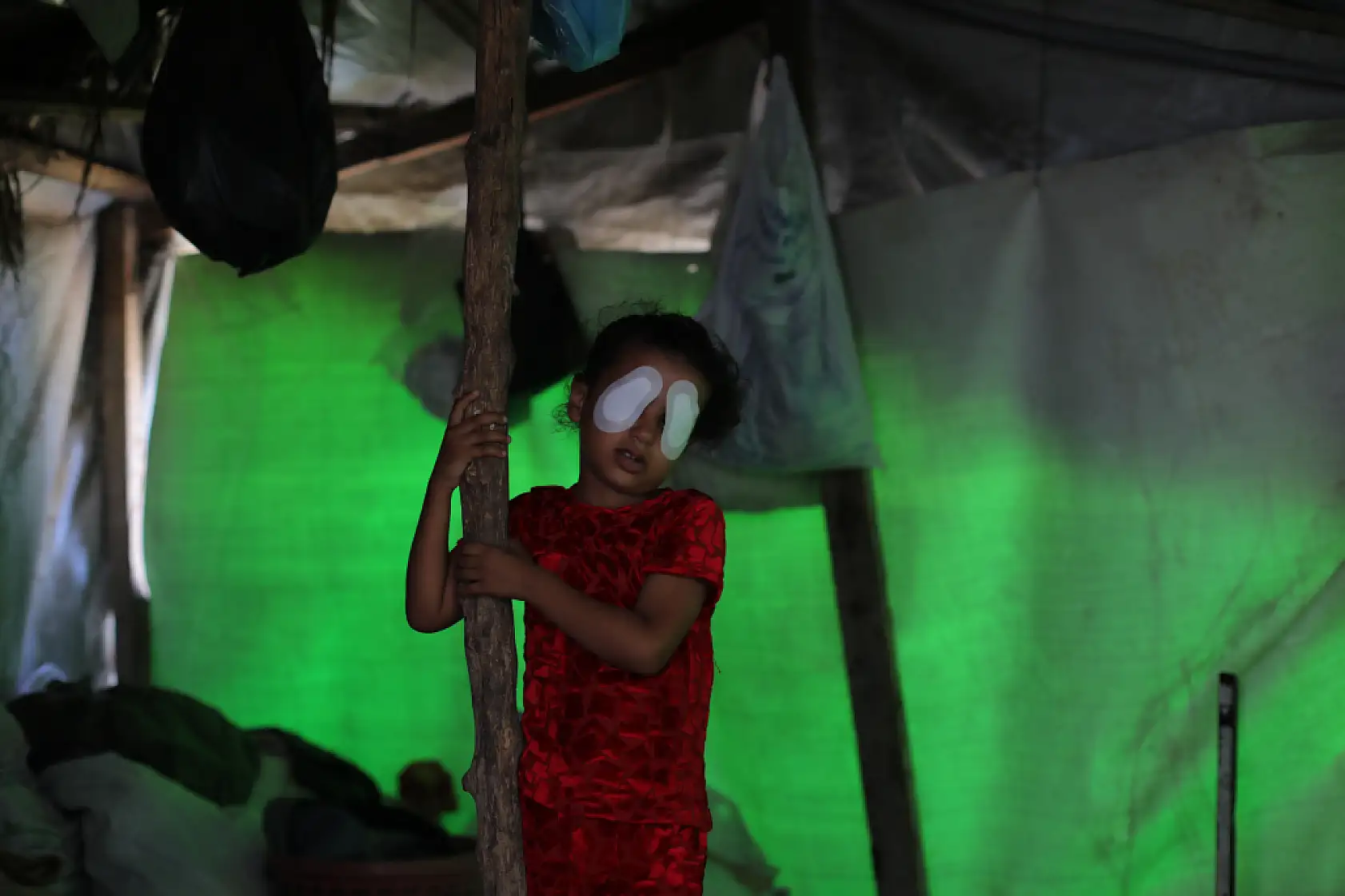 Gözüne şarapnel isabet eden çocuk, görme yetisini kaybetme korkusu yaşıyor