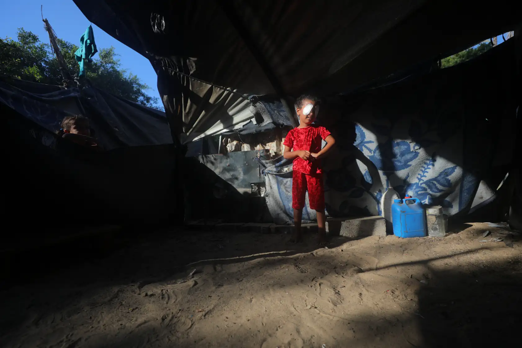 Gözüne şarapnel isabet eden çocuk, görme yetisini kaybetme korkusu yaşıyor