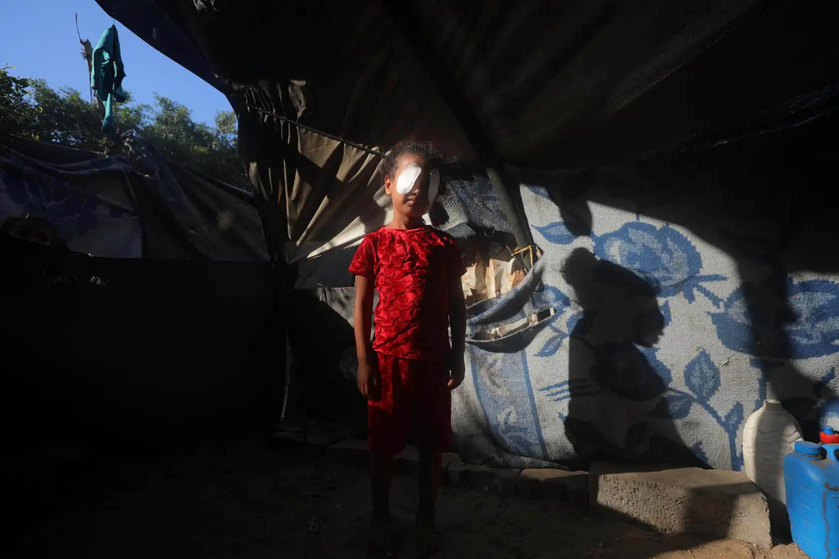 Gözüne şarapnel isabet eden çocuk, görme yetisini kaybetme korkusu yaşıyor