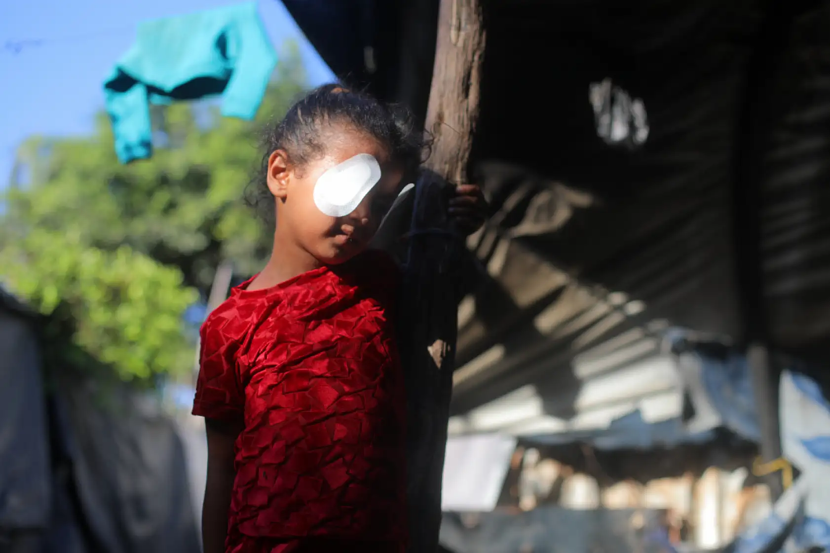Gözüne şarapnel isabet eden çocuk, görme yetisini kaybetme korkusu yaşıyor