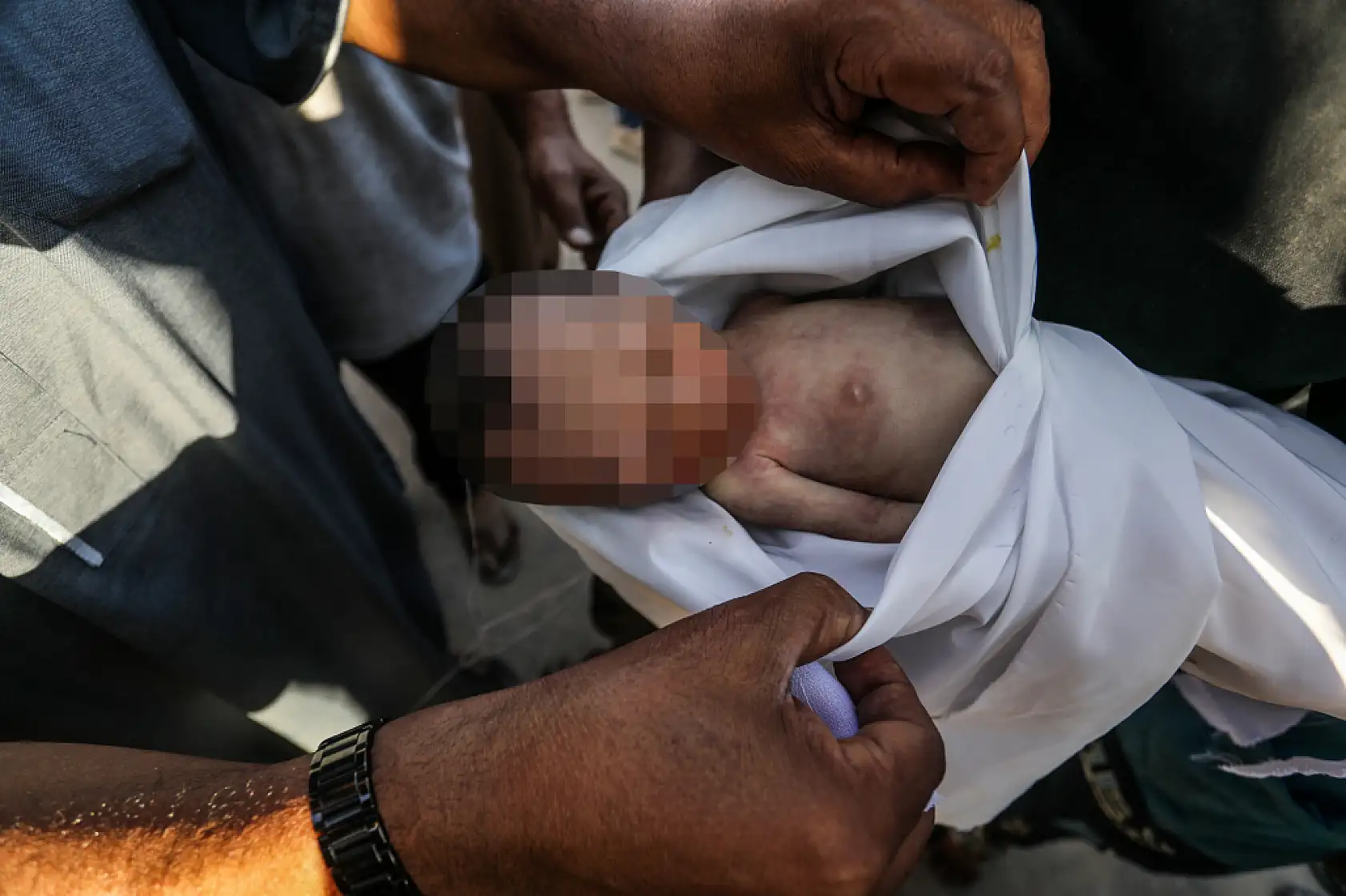 Bir bebek daha açlığa yenik düştü