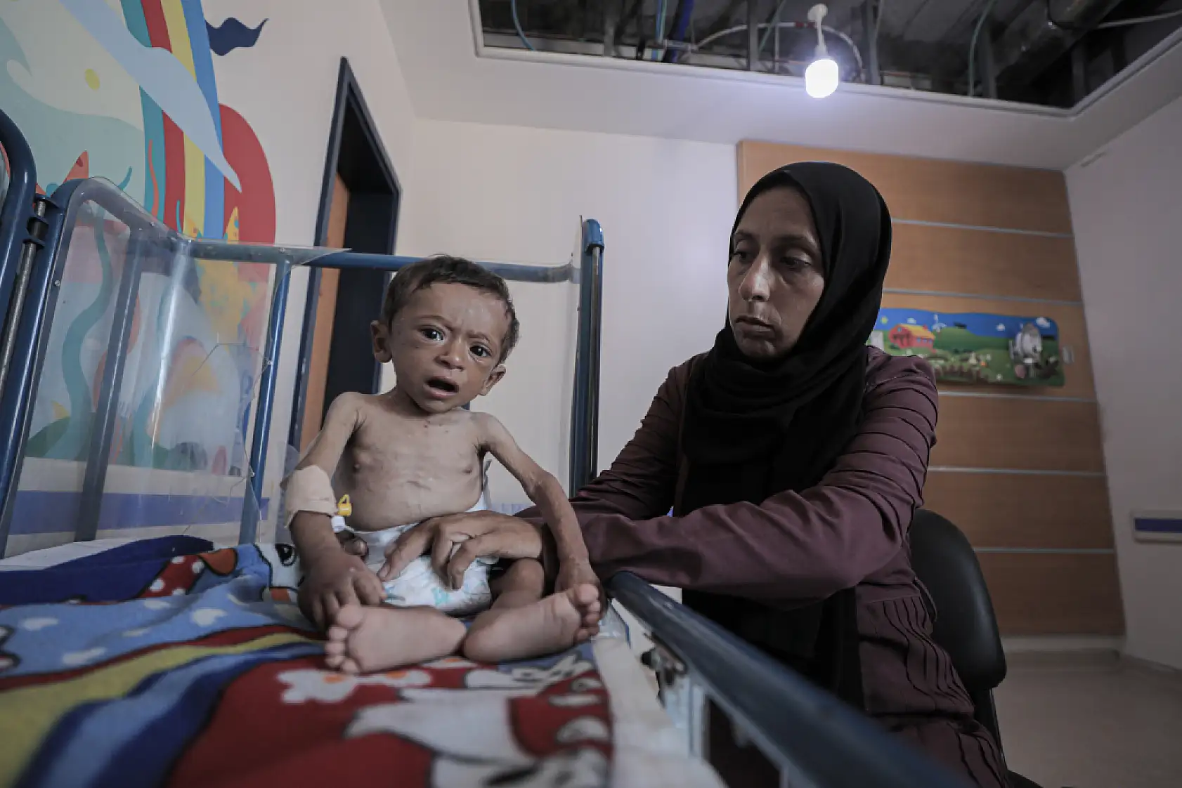 7 aylık bebek ölümün eşiğinde!