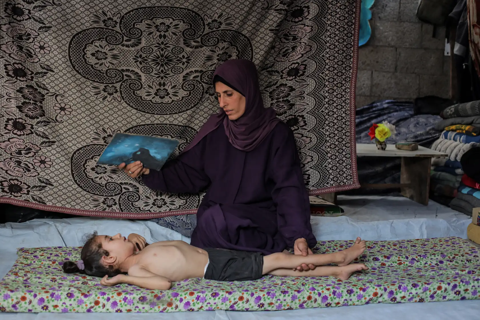 5 yaşındaki Dalya, oksijen eksikliği ve yetersiz beslenme sorunuyla mücadele ediyor