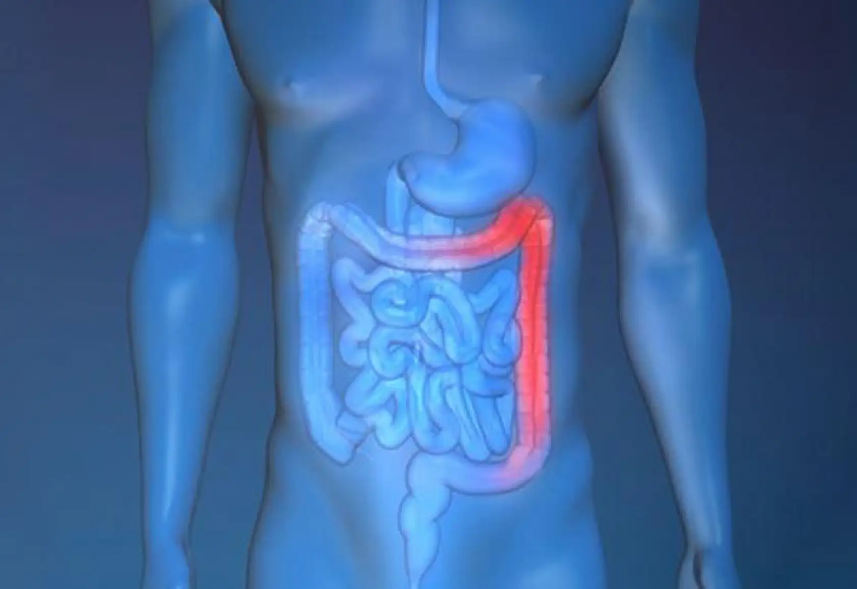 Kolon Kanserine karşı düzenli tarama şart!