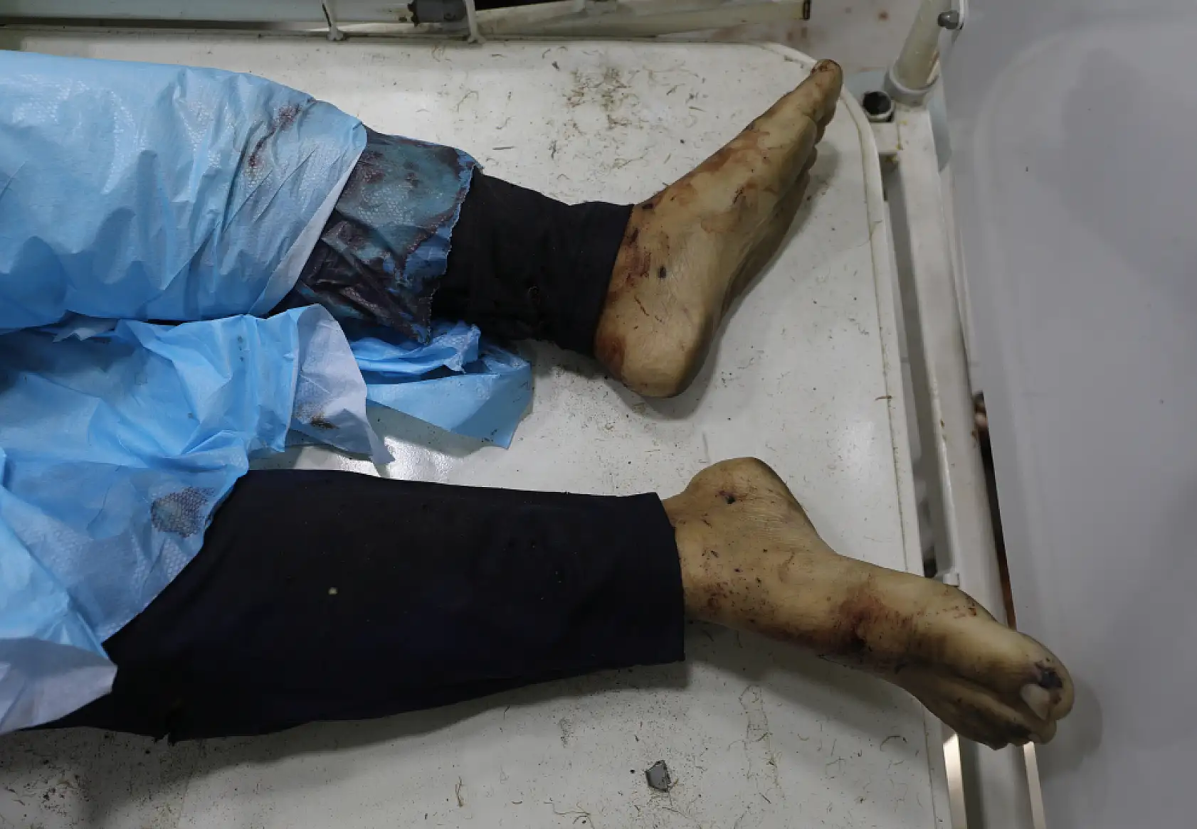 Gazze'de can kaybı gün geçtikçe artıyor