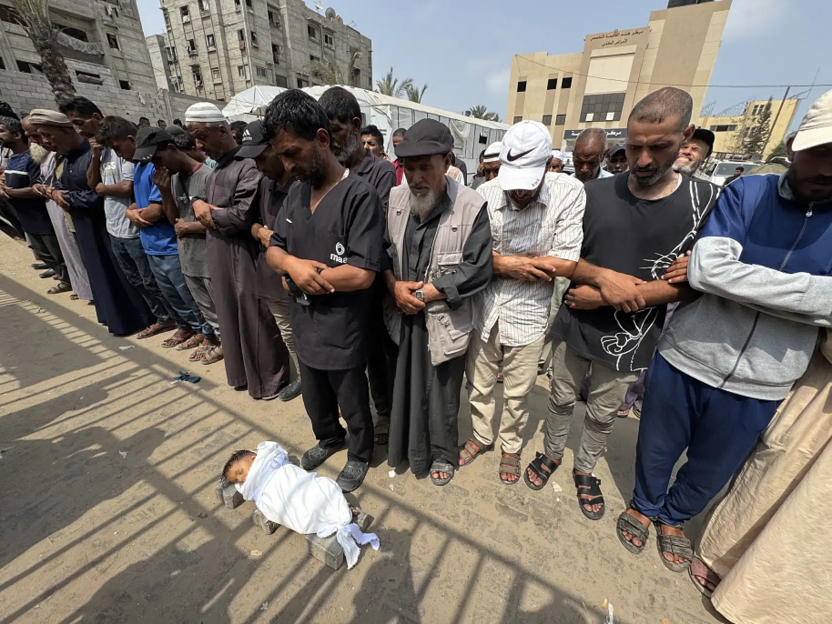 5 yaşındaki çocuk yetersiz beslenme nedeniyle hayatını kaybetti