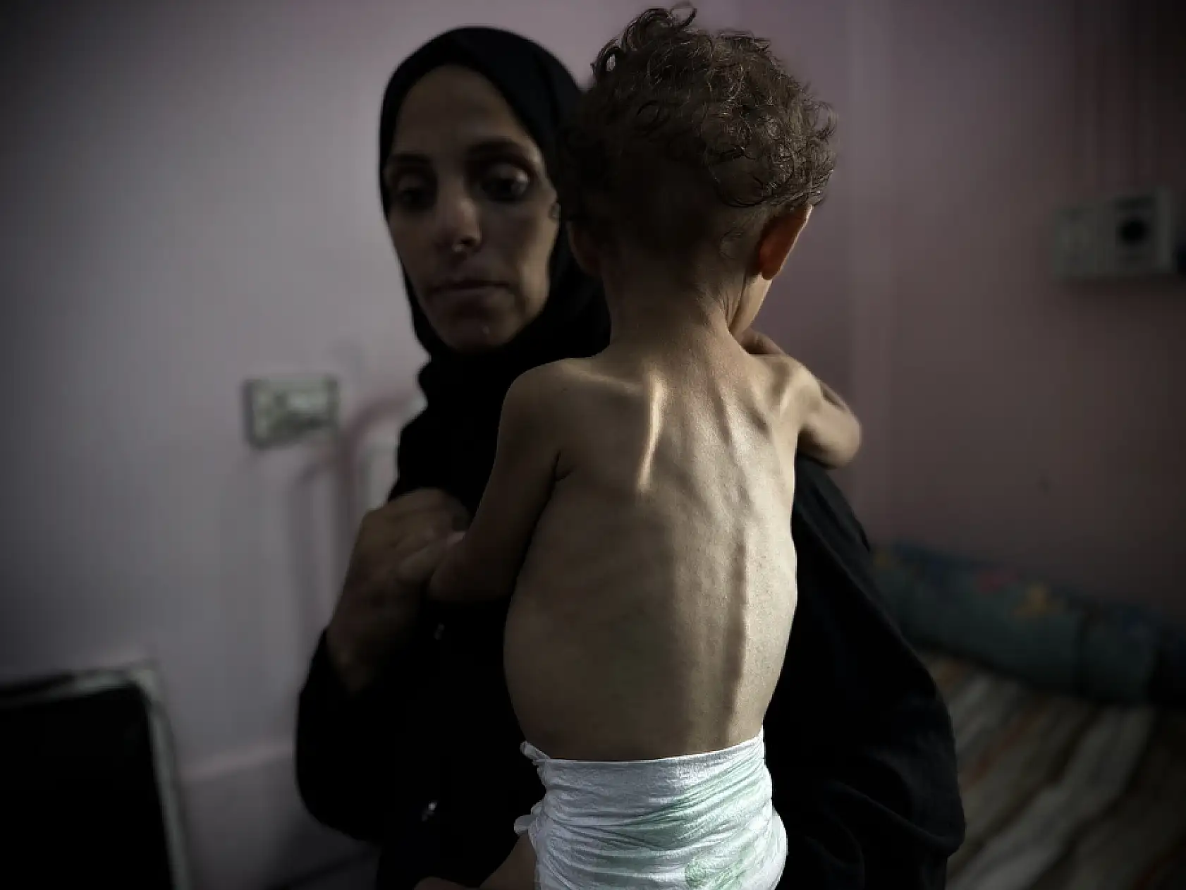 Gazze'de bebekler açlıkla mücade ediyor