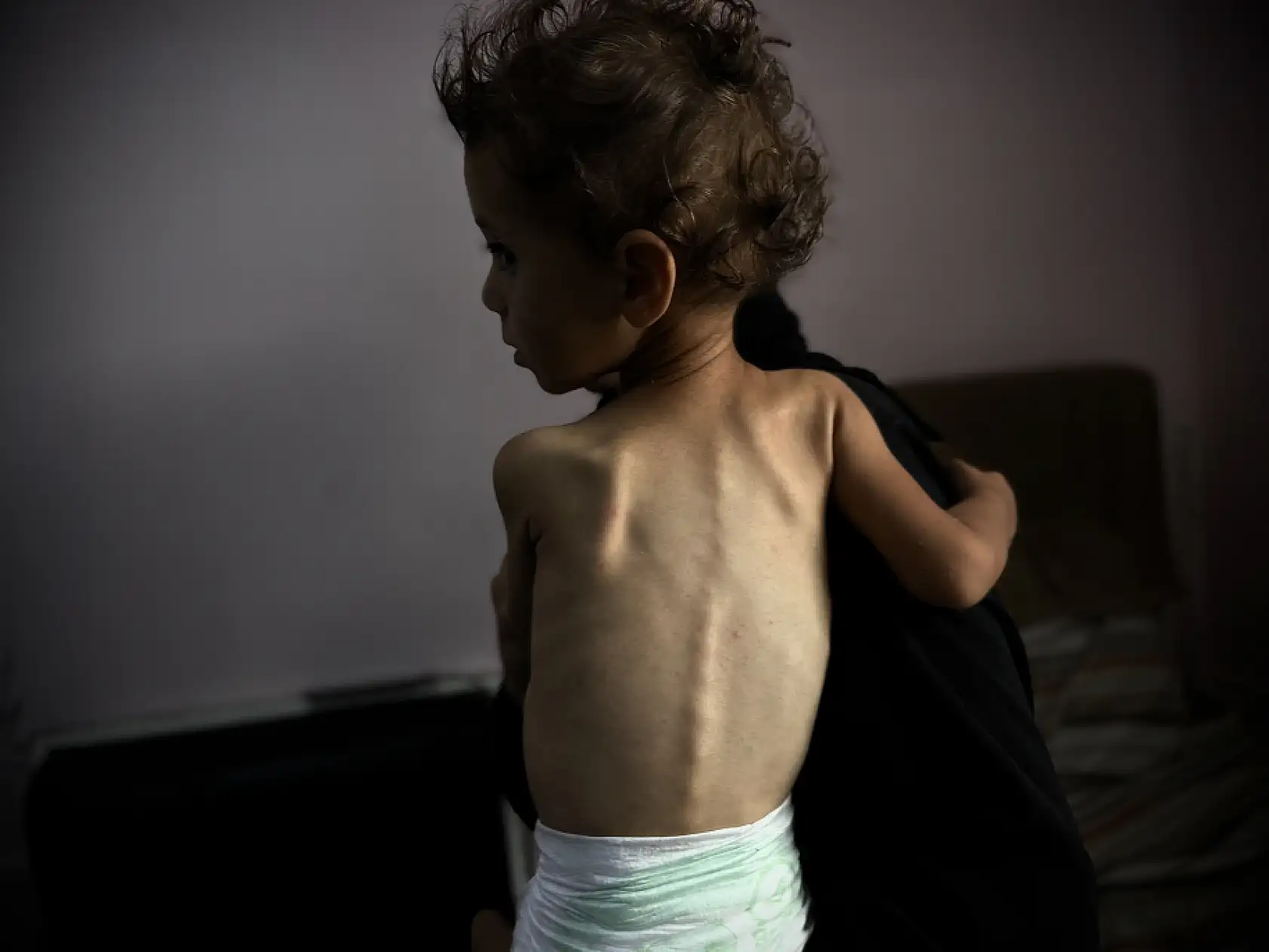 Gazze'de bebekler açlıkla mücade ediyor