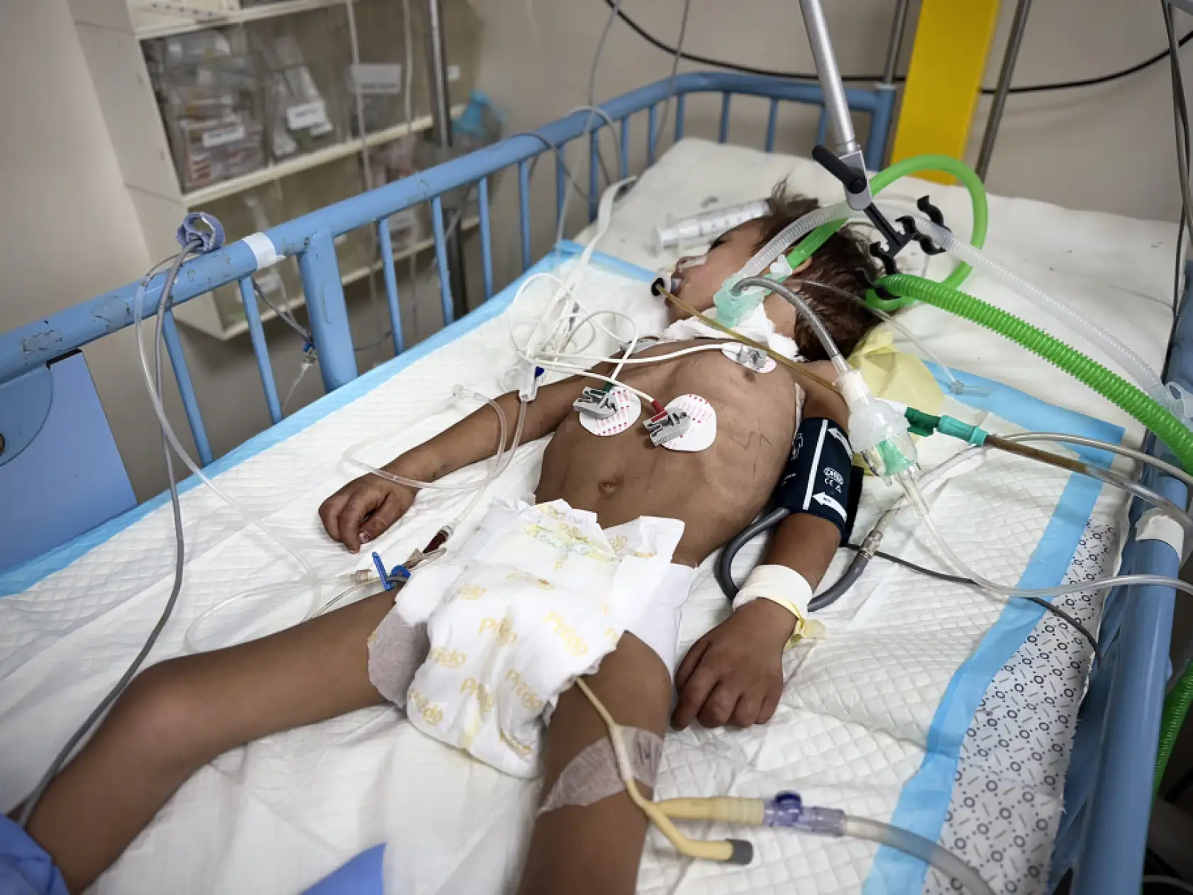 Gazze'de çocuklar açıkla mücadele ediyor!