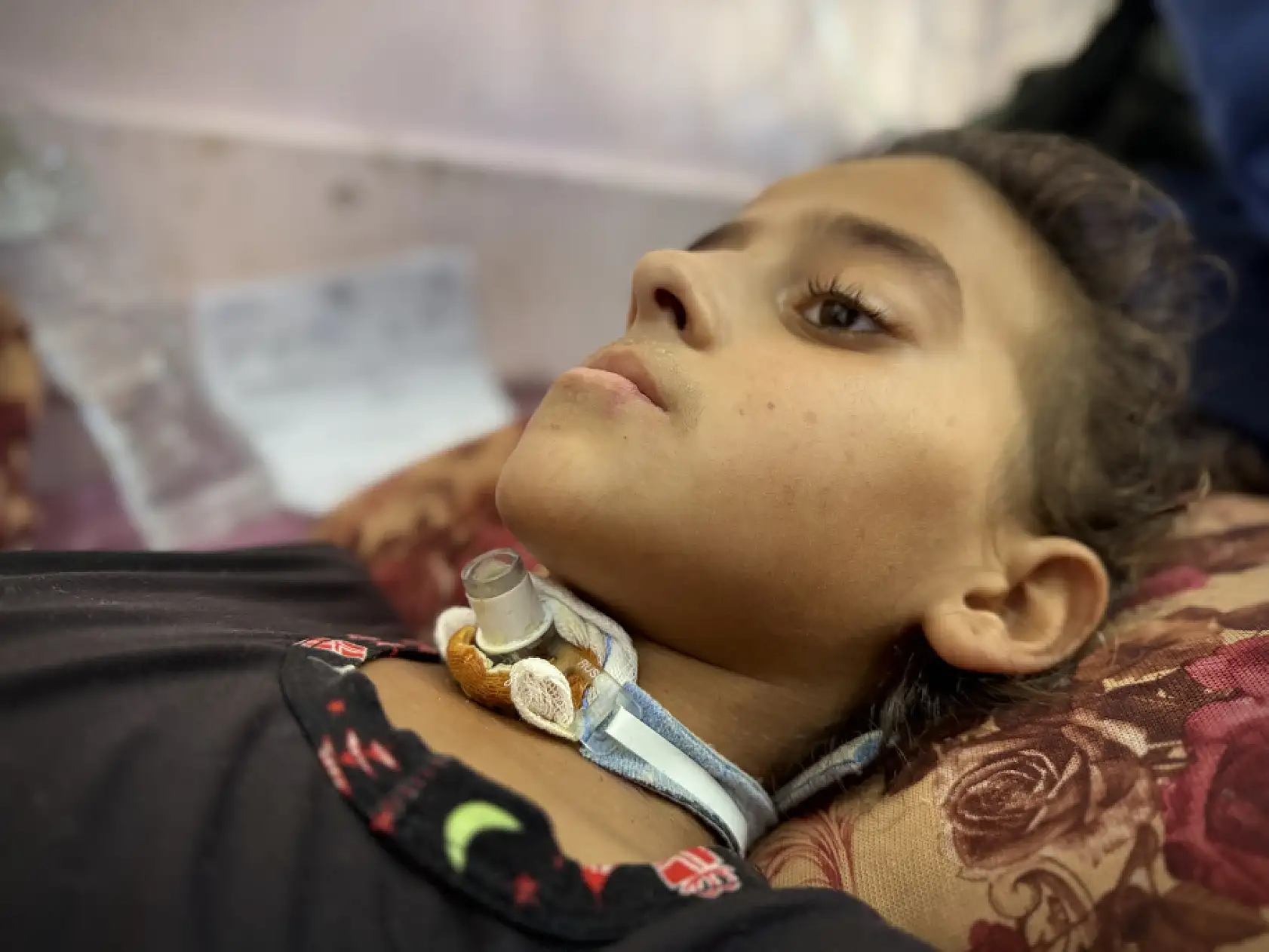 Gazze'de çocuklar açıkla mücadele ediyor!