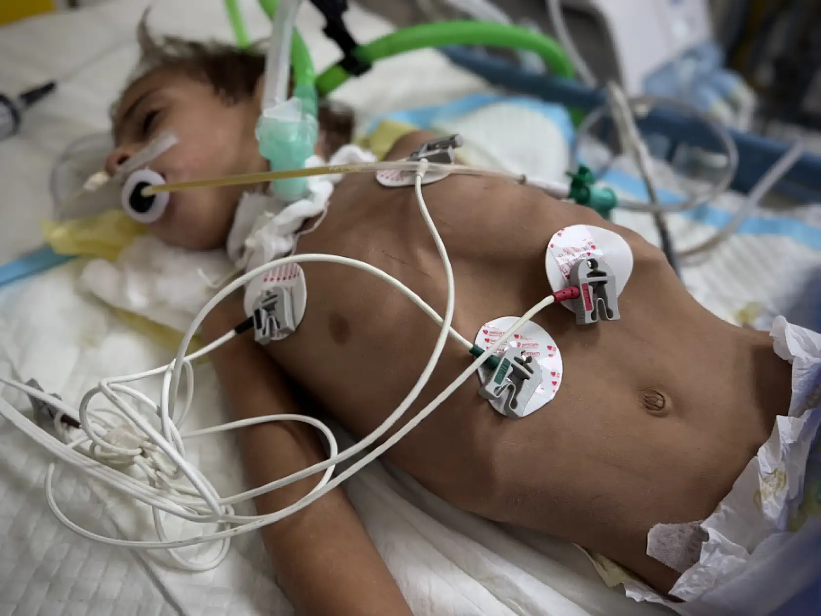 Gazze'de çocuklar açıkla mücadele ediyor!