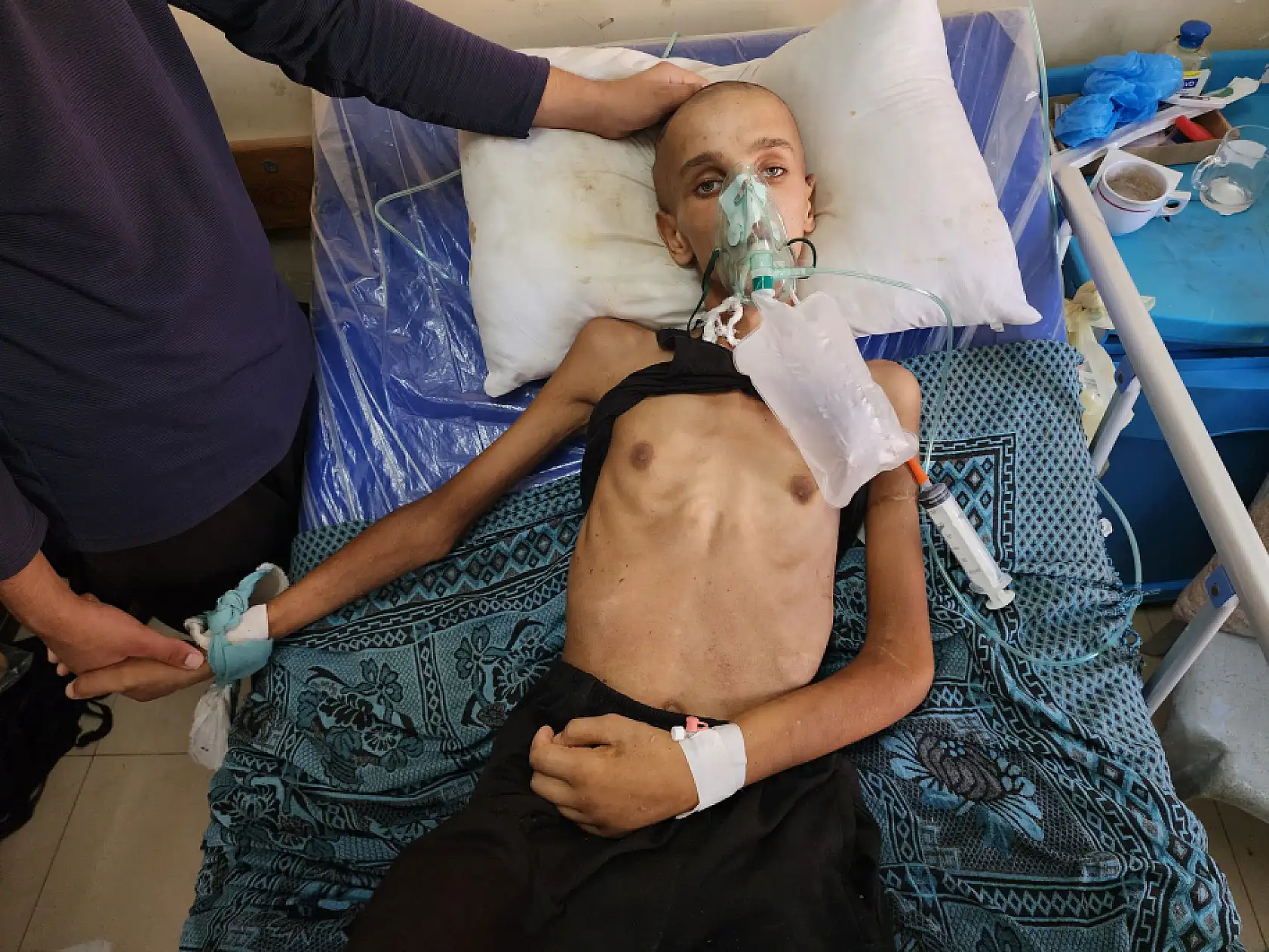 Yaralı çocuk yaşam mücadelesi veriyor: Yetersiz beslenme sonucu 20 kilo kaybetti