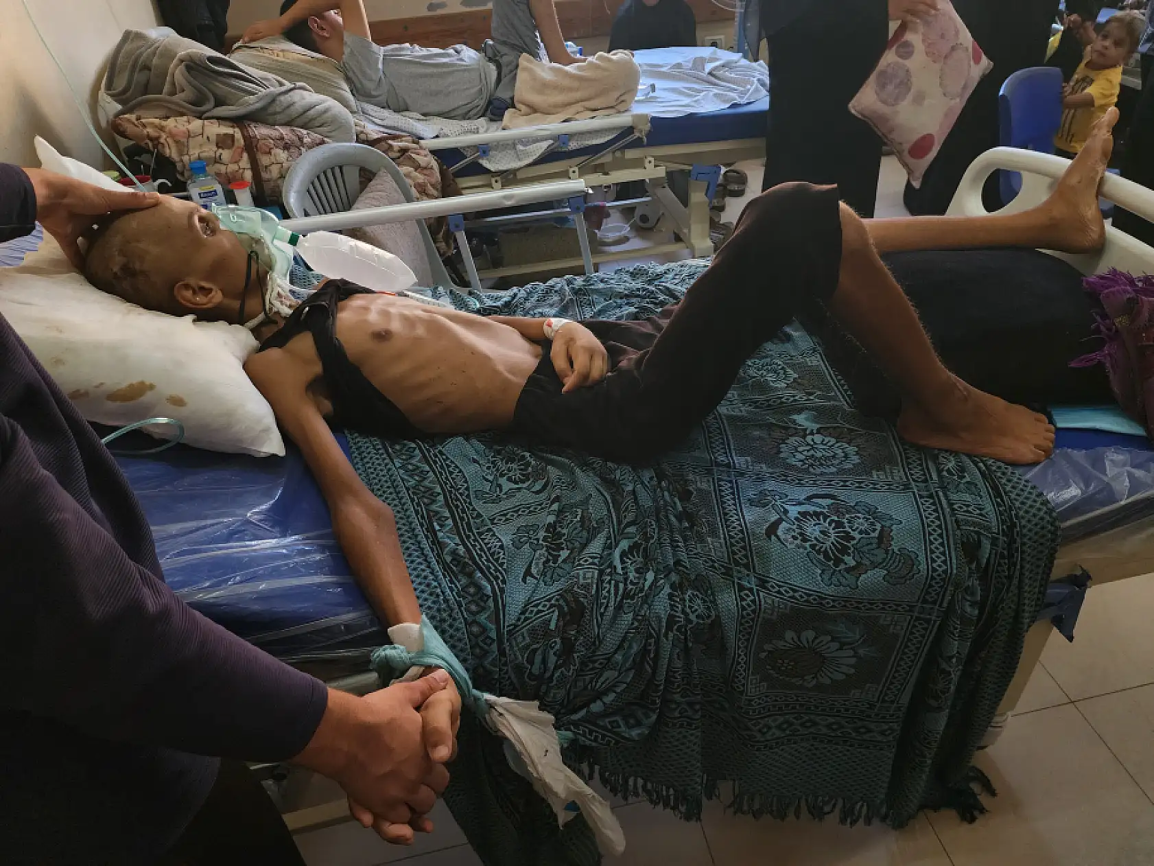 Yaralı çocuk yaşam mücadelesi veriyor: Yetersiz beslenme sonucu 20 kilo kaybetti