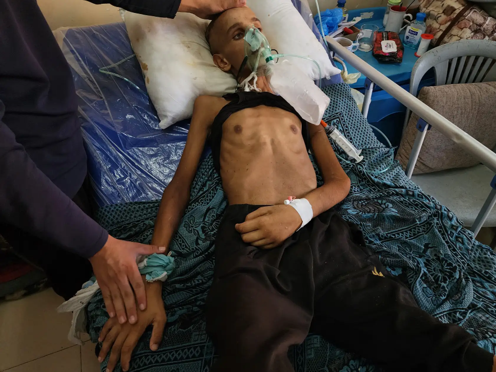 Yaralı çocuk yaşam mücadelesi veriyor: Yetersiz beslenme sonucu 20 kilo kaybetti