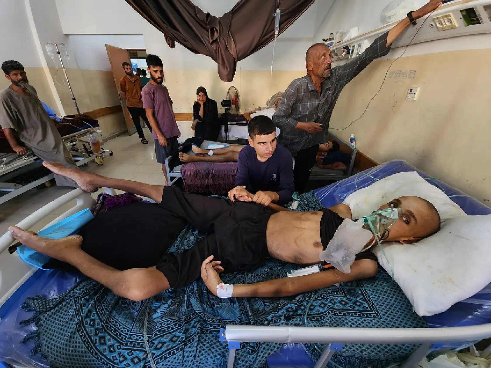 Yaralı çocuk yaşam mücadelesi veriyor: Yetersiz beslenme sonucu 20 kilo kaybetti