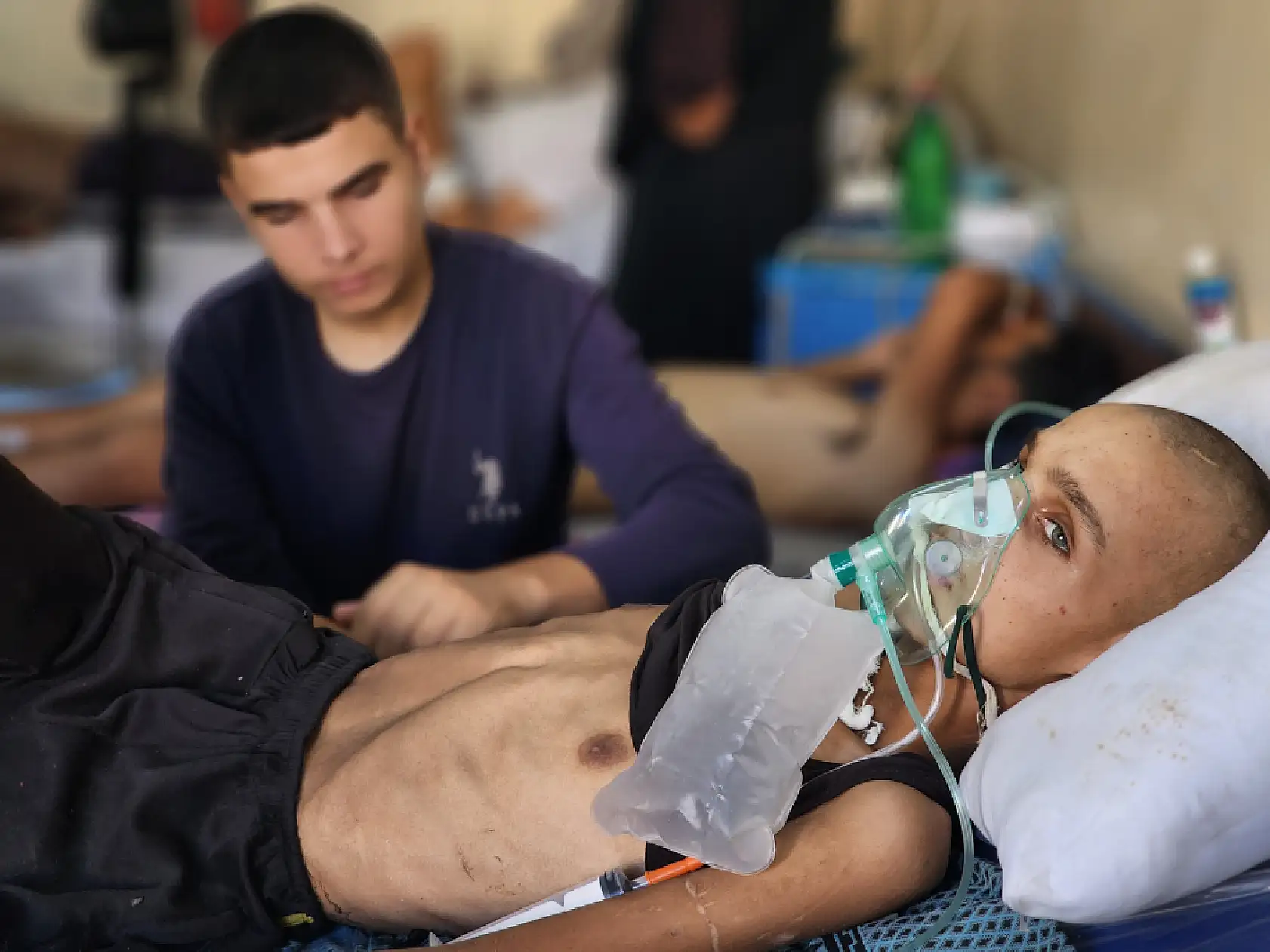 Yaralı çocuk yaşam mücadelesi veriyor: Yetersiz beslenme sonucu 20 kilo kaybetti