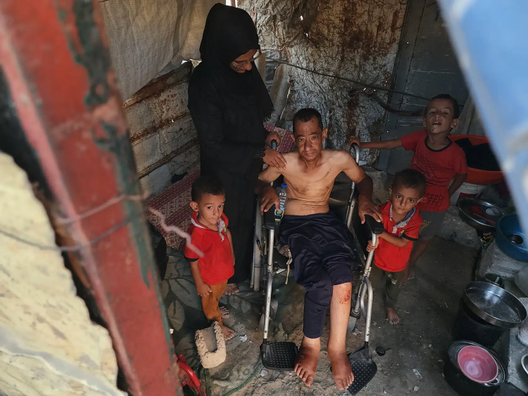 Gazze'de felçli Ahmed, ilaç ve tedaviye ulaşamıyor