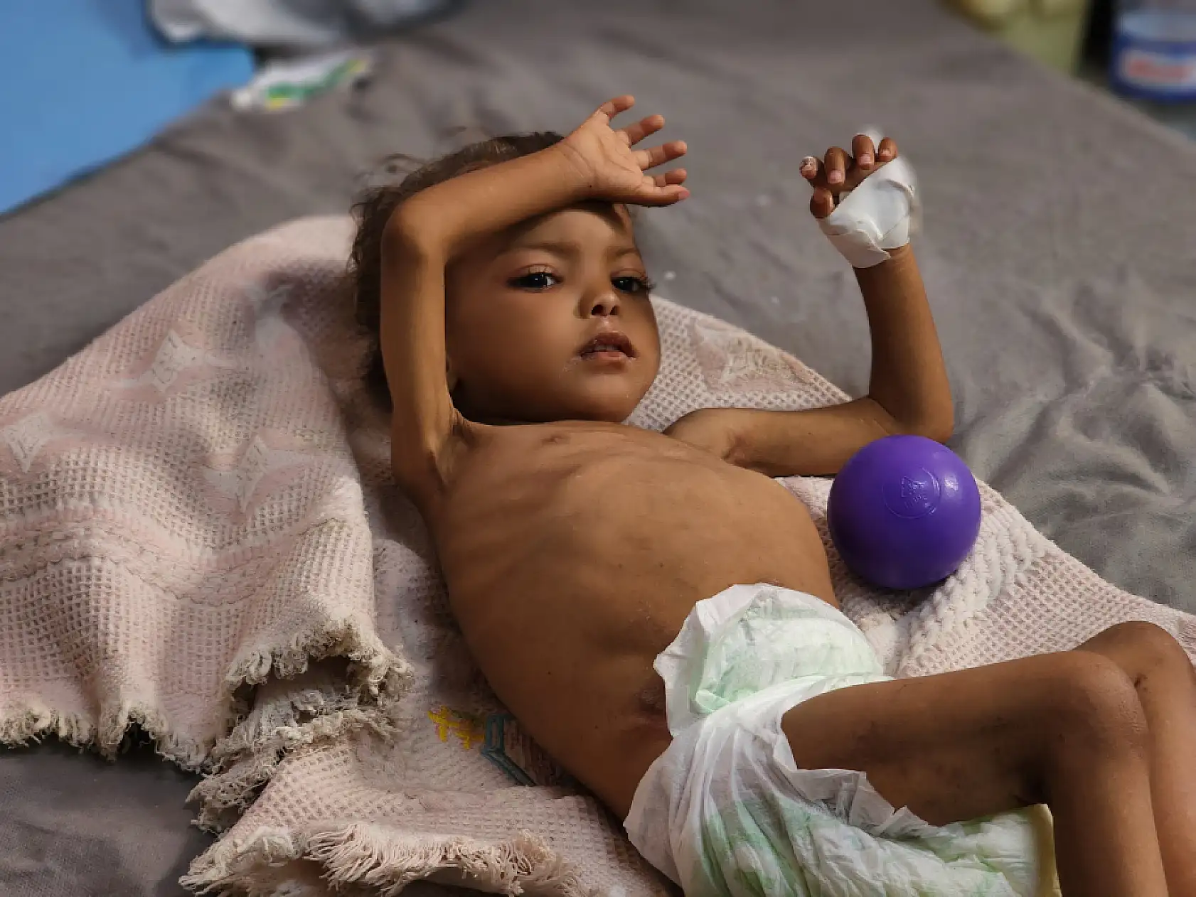 Yetersiz beslenme nedeniyle çocuk ölümleri artıyor!