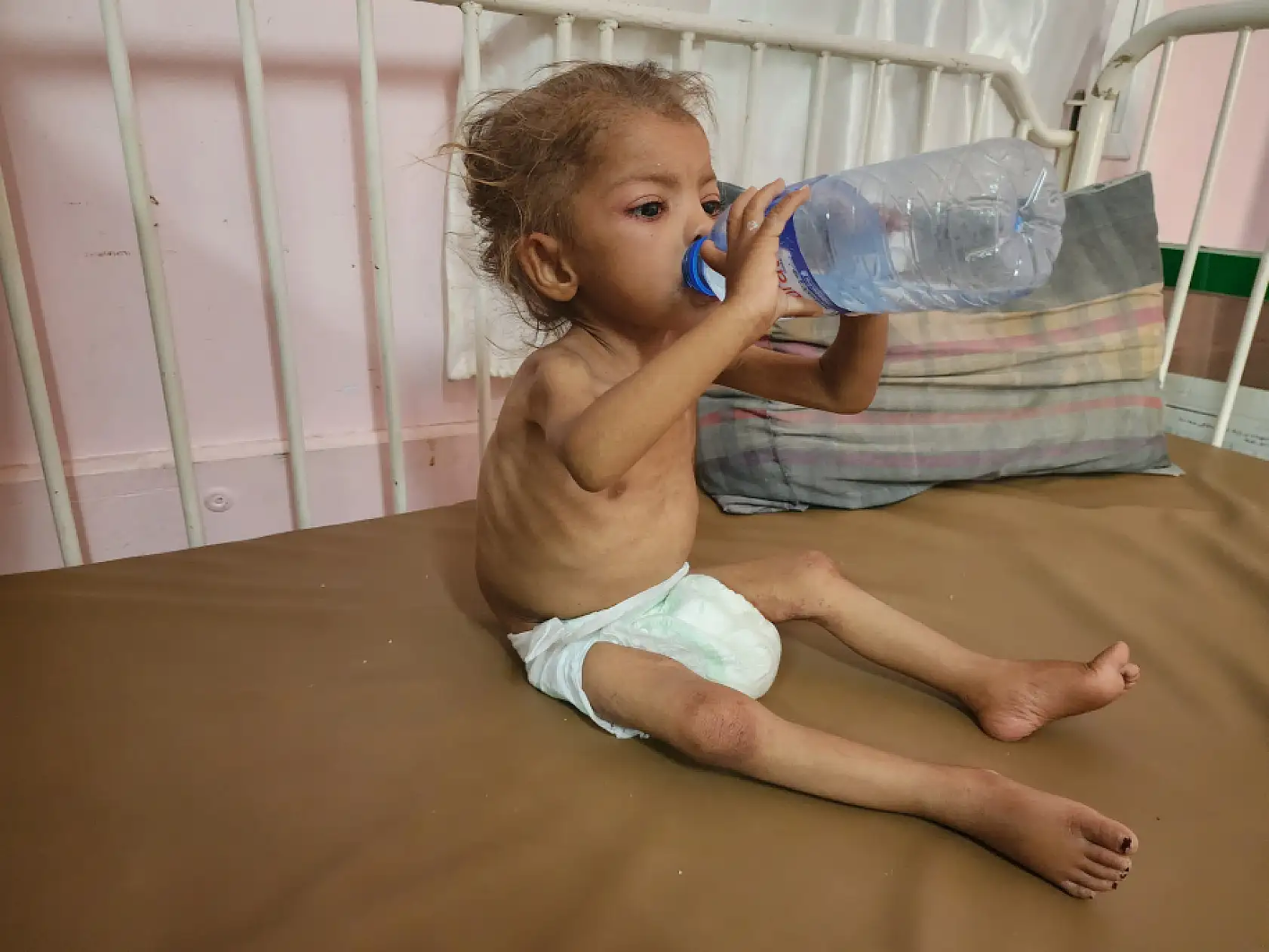 Yetersiz beslenme nedeniyle çocuk ölümleri artıyor!