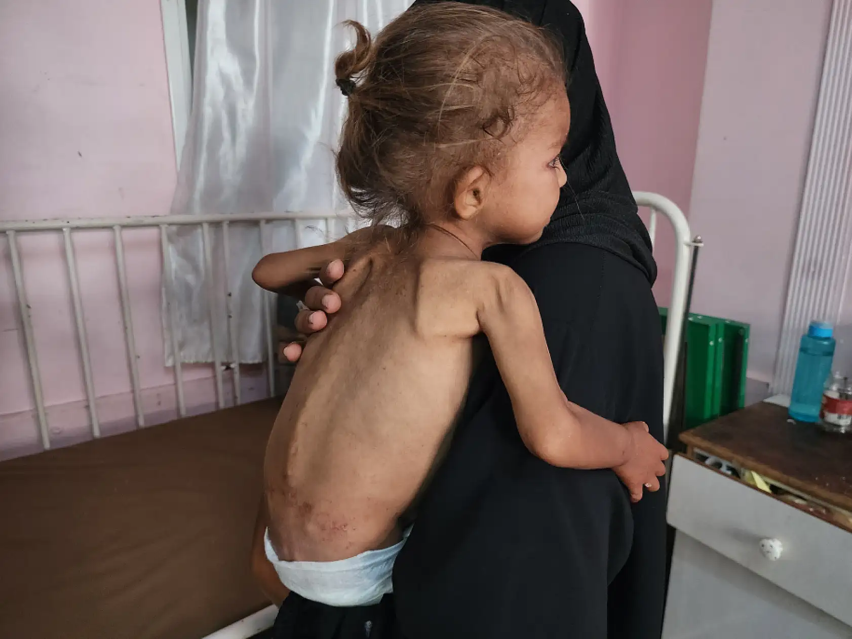 Yetersiz beslenme nedeniyle çocuk ölümleri artıyor!