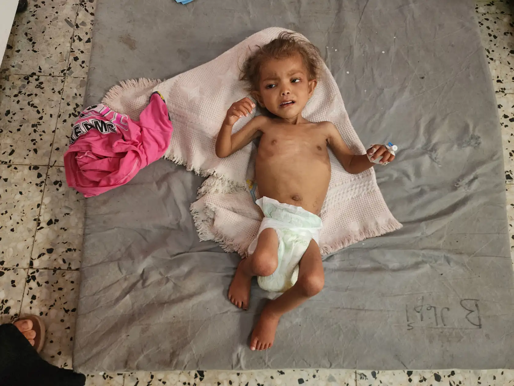 Yetersiz beslenme nedeniyle çocuk ölümleri artıyor!