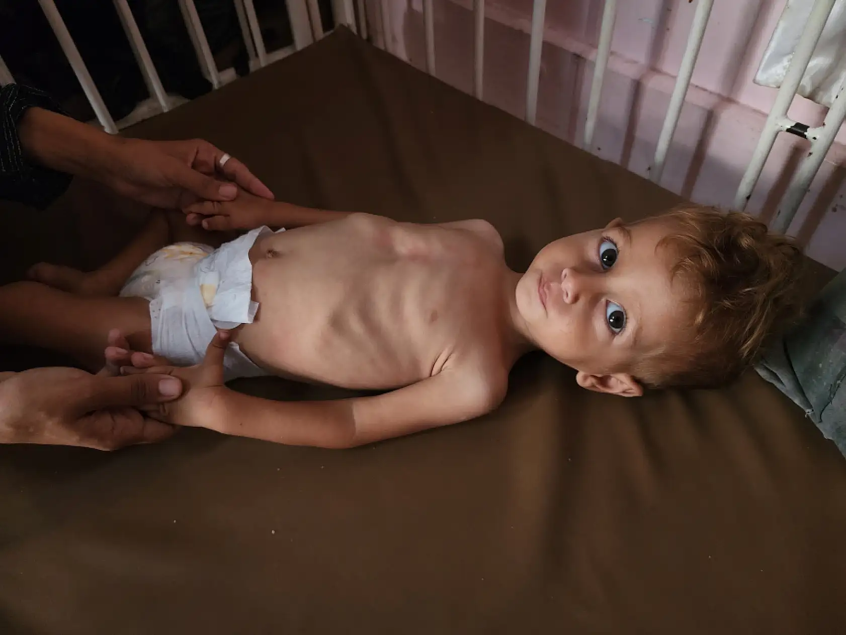 Yetersiz beslenme nedeniyle çocuk ölümleri artıyor!