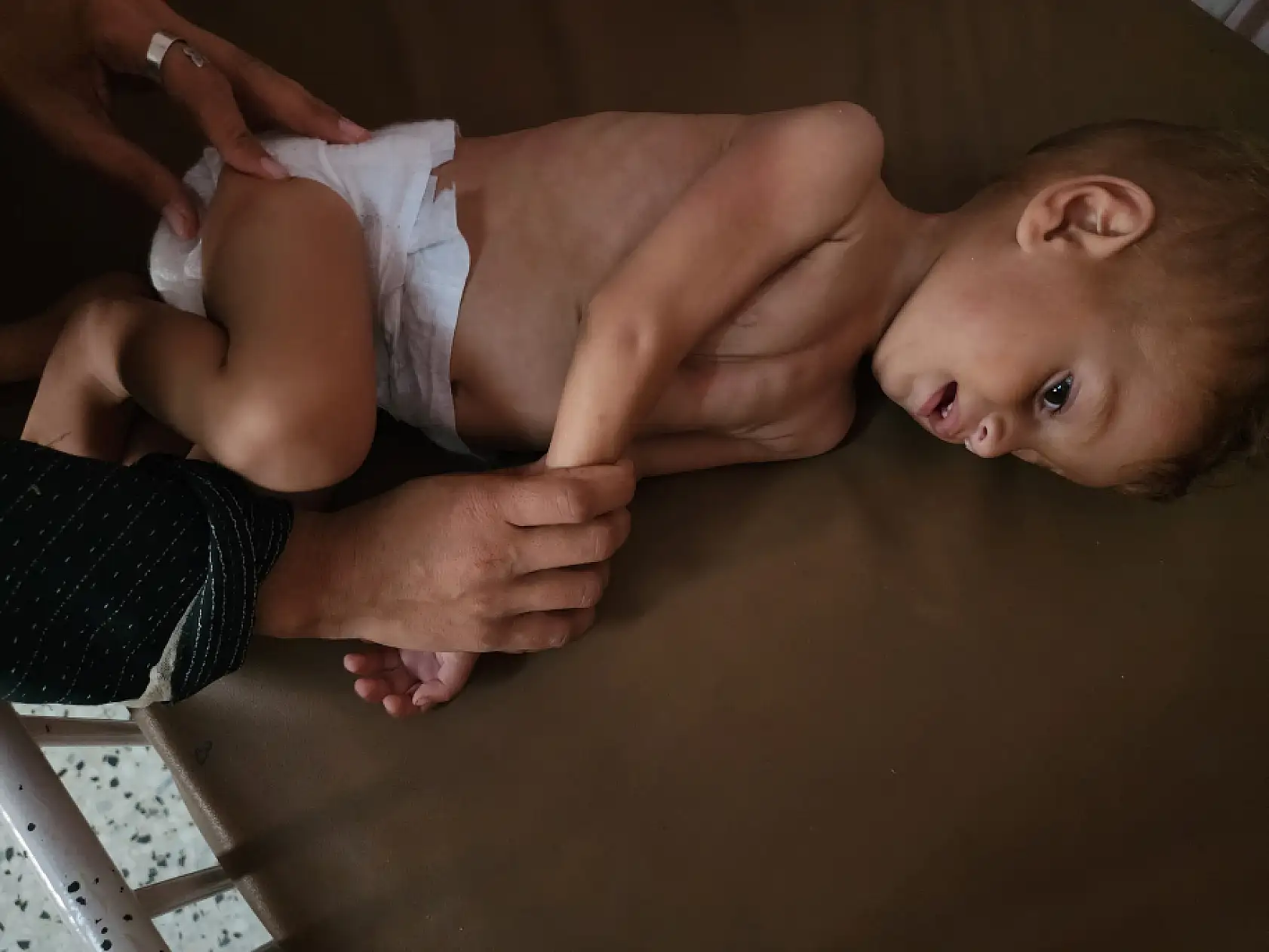 Yetersiz beslenme nedeniyle çocuk ölümleri artıyor!